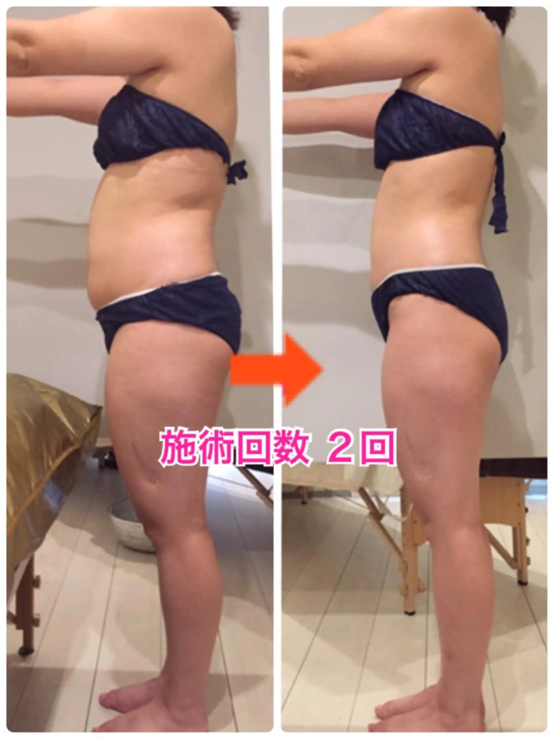 ショート カラー パーマ ヘアアレンジ メンズ キッズ ネイル マツエク・マツパ ‍痩身＆ボディ 結果出し🌟丹野のエステ・リラクイメージ