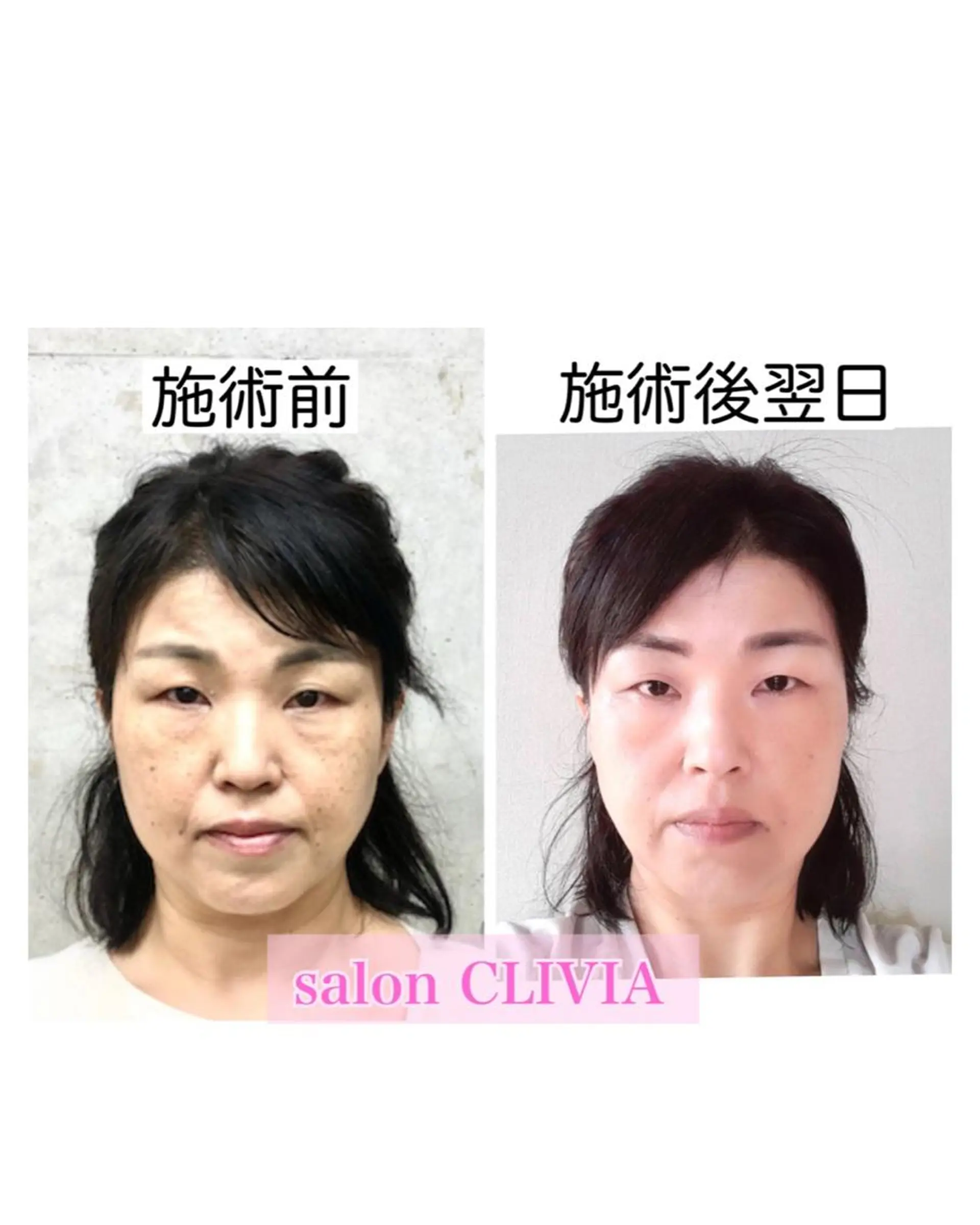 salon CLIVIA, クリヴィア所属・無痛小顔矯正 クリヴィアのエステ・リラクイメージ