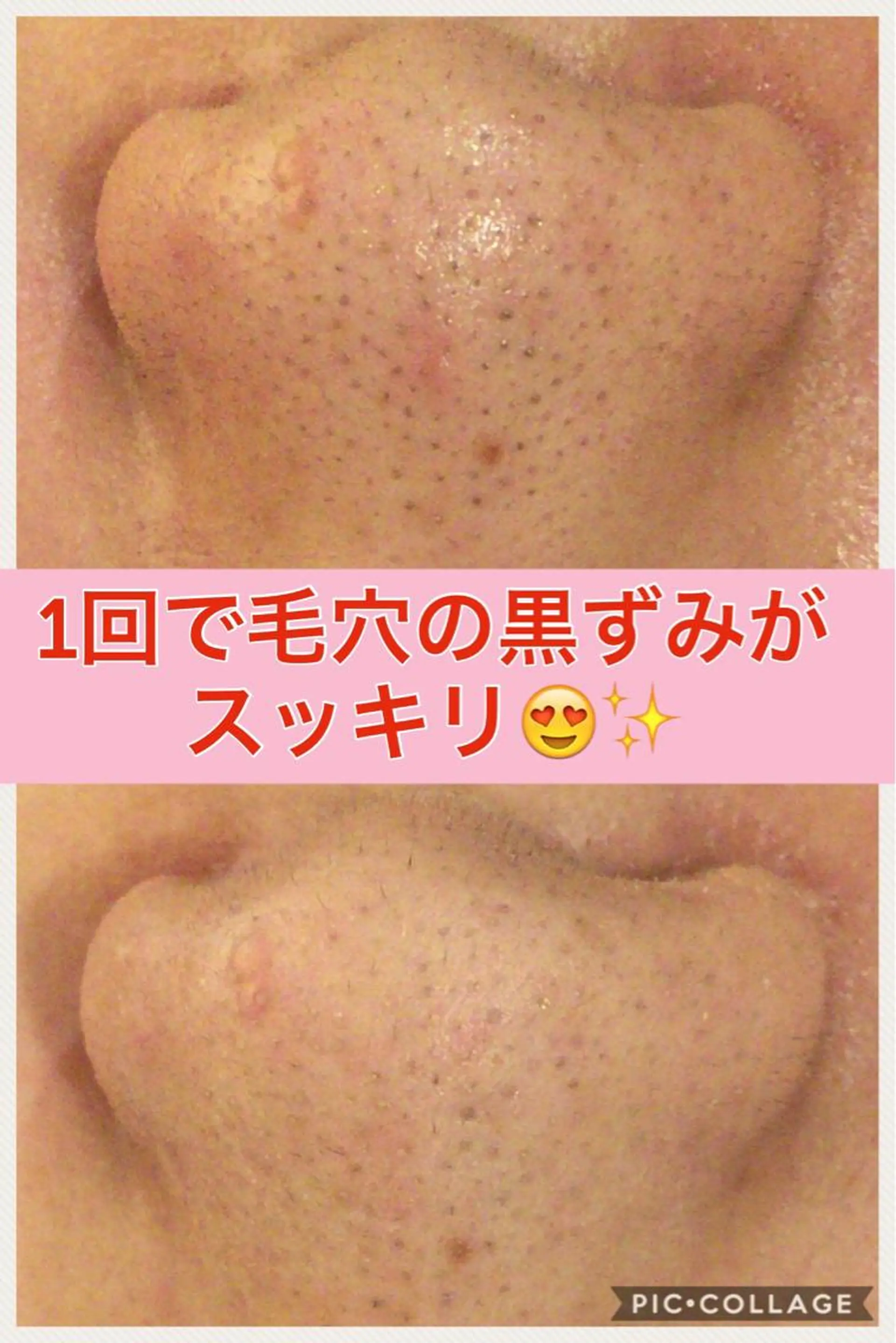 ショート カラー パーマ ヘアアレンジ メンズ キッズ ネイル マツエク・マツパ ニキビ・肌質改善専門 ♡人生が変わるサロンのエステ・リラクイメージ