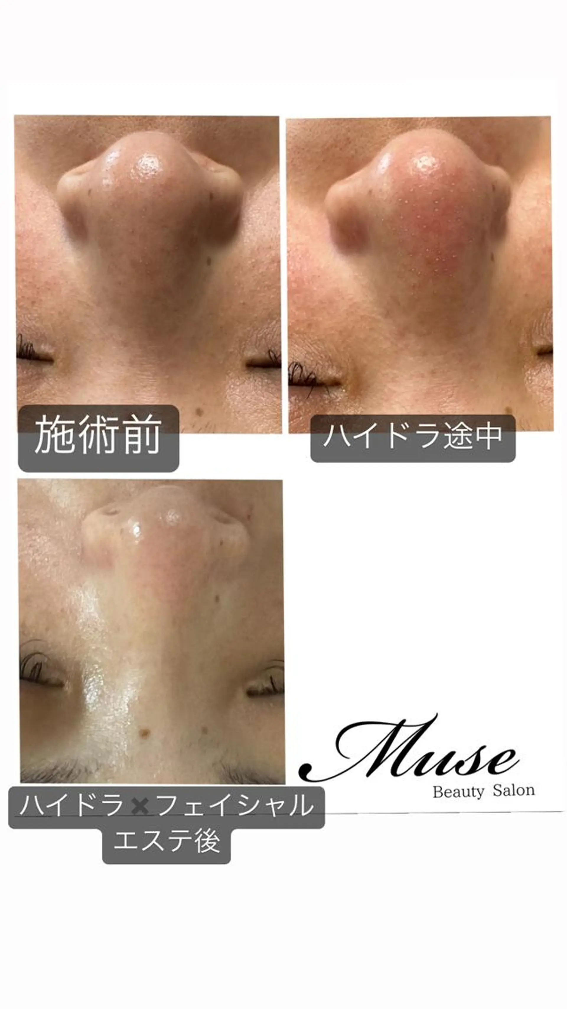 医療提携Beauty SalonMuseのエステ・リラクイメージ