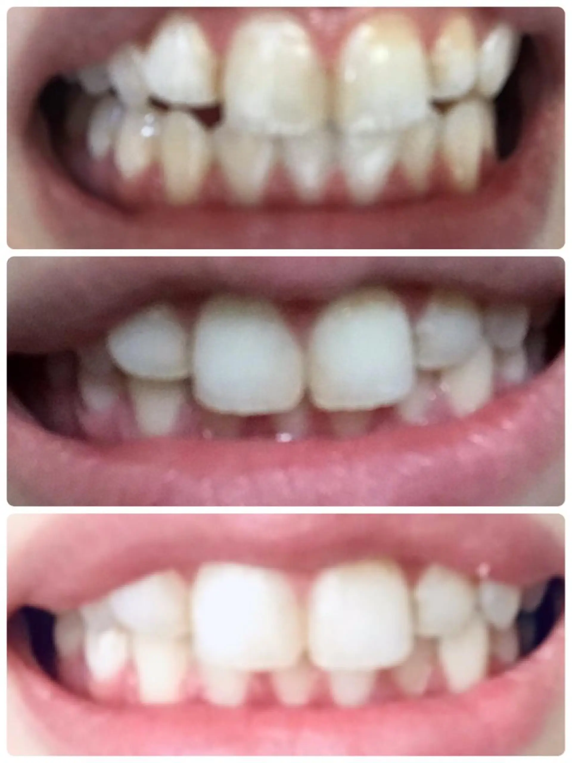 小顔サロン ソ.ルシエのエステ・リラクイメージ