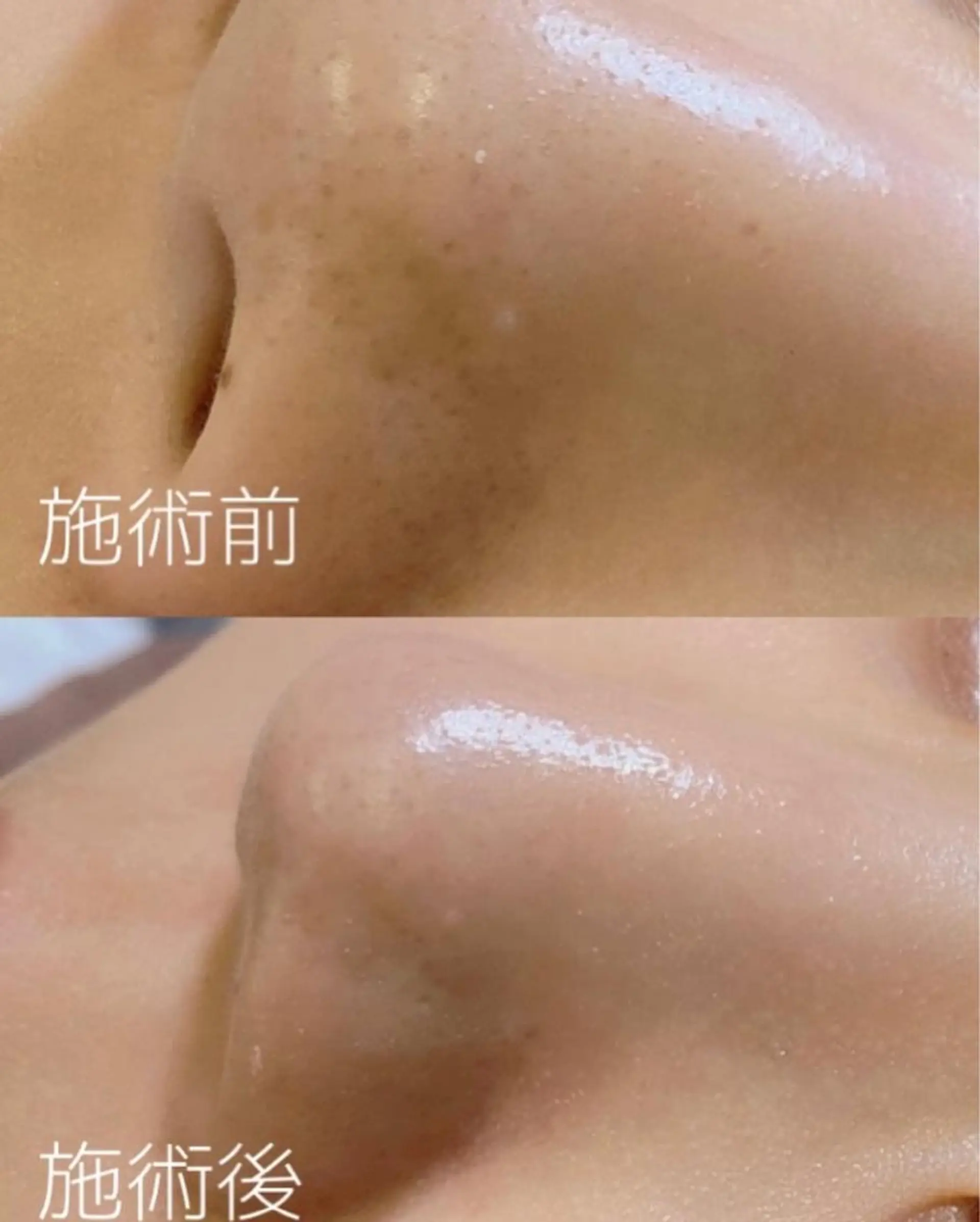 エステ 杵築👀 まつげサロン~MDKのマツエク・マツパデザイン