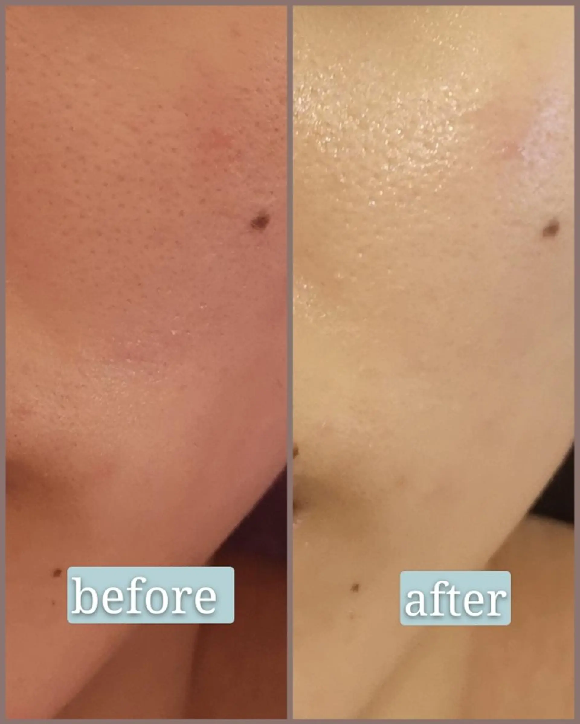 🅖🅤🅩🅔🅛 salonのエステ・リラクイメージ