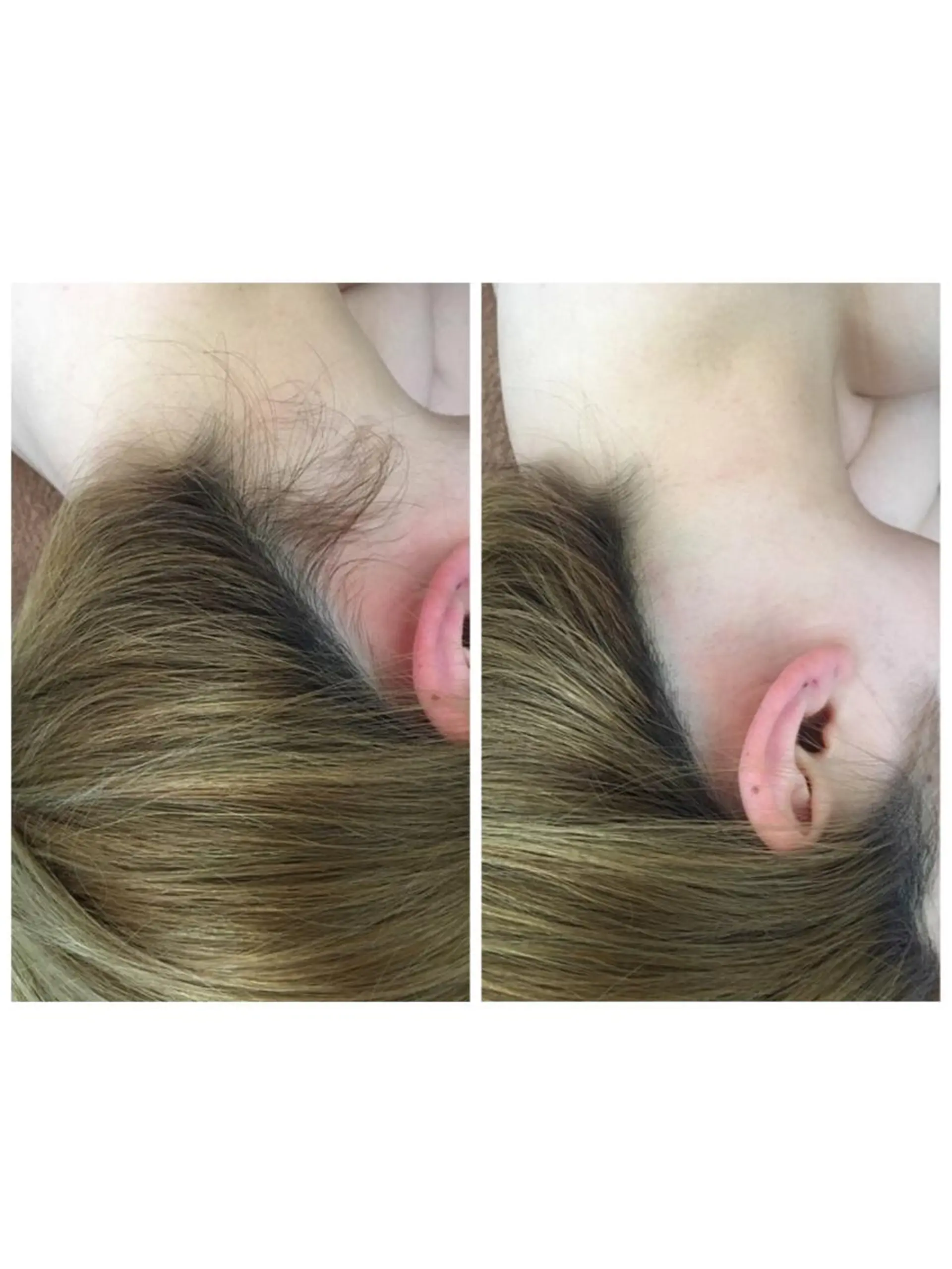 脱毛＆肌質改善サロン shandeelのエステ・リラクイメージ