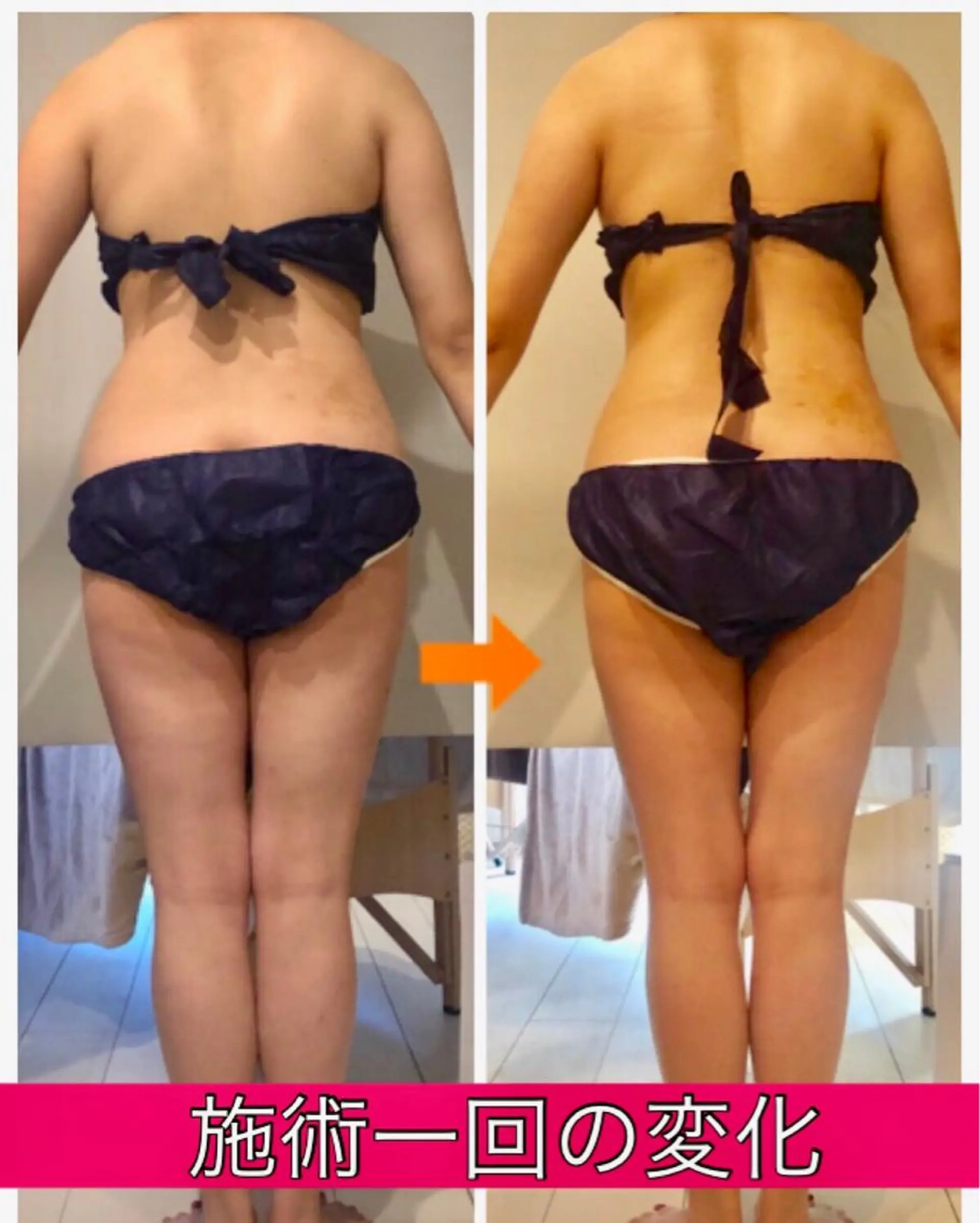 ロング カラー パーマ ヘアアレンジ メンズ キッズ ネイル マツエク・マツパ ‍痩身＆ボディ 結果出し🌟丹野のエステ・リラクイメージ