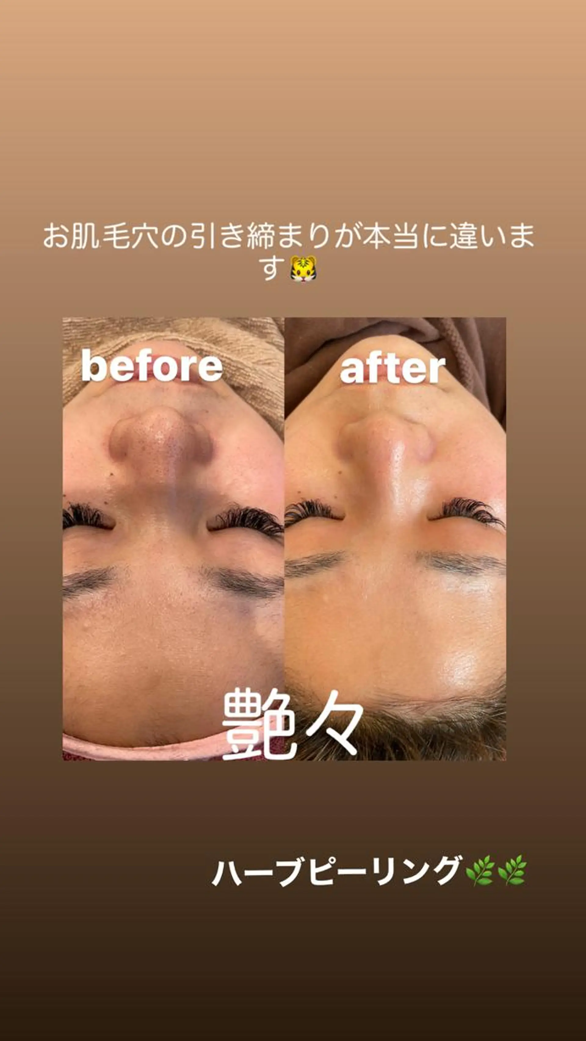 VERY VERY九条店所属・VERY VERY 九条店のエステ・リラクイメージ