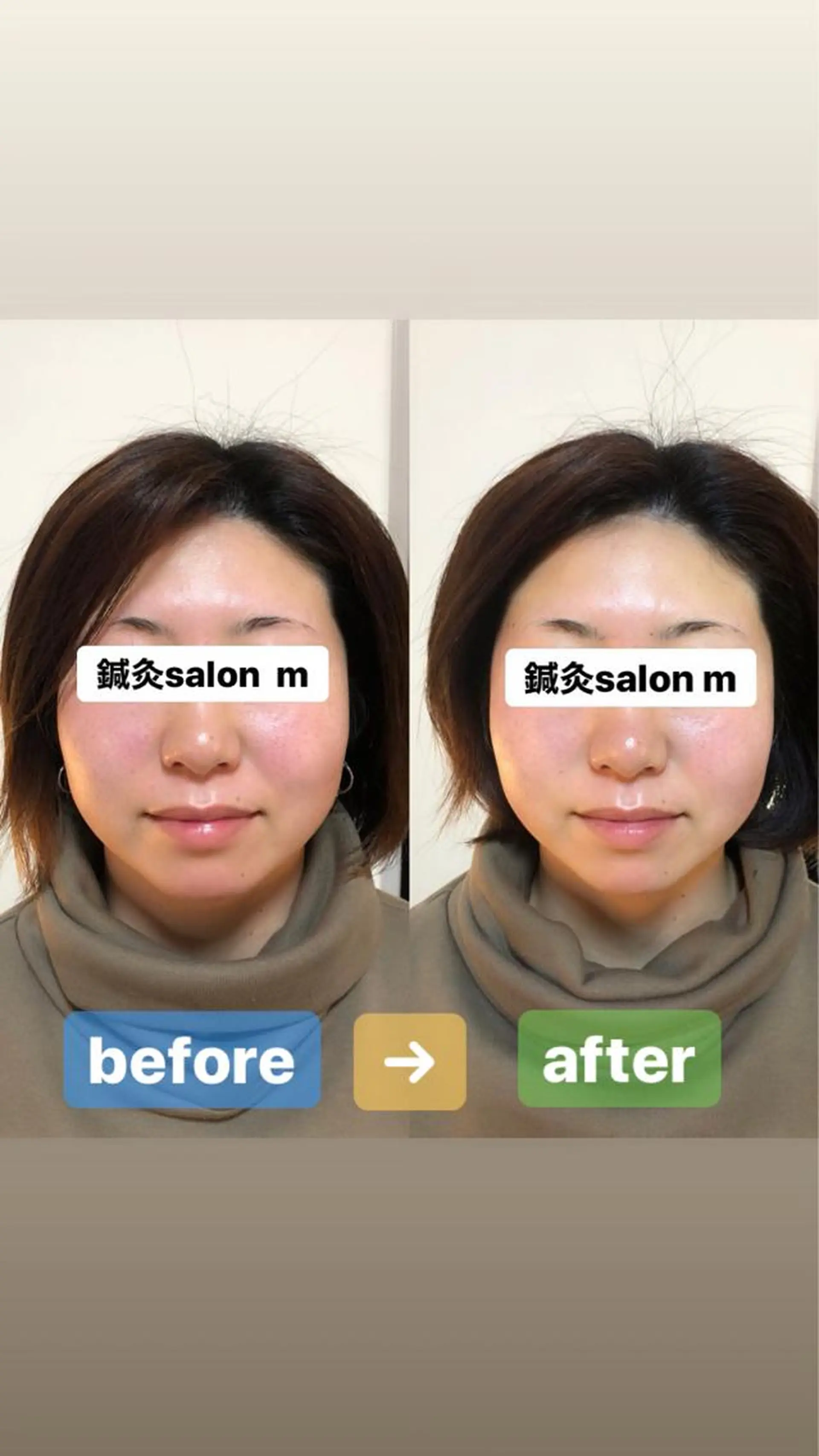 鍼灸salon mのエステ・リラクイメージ