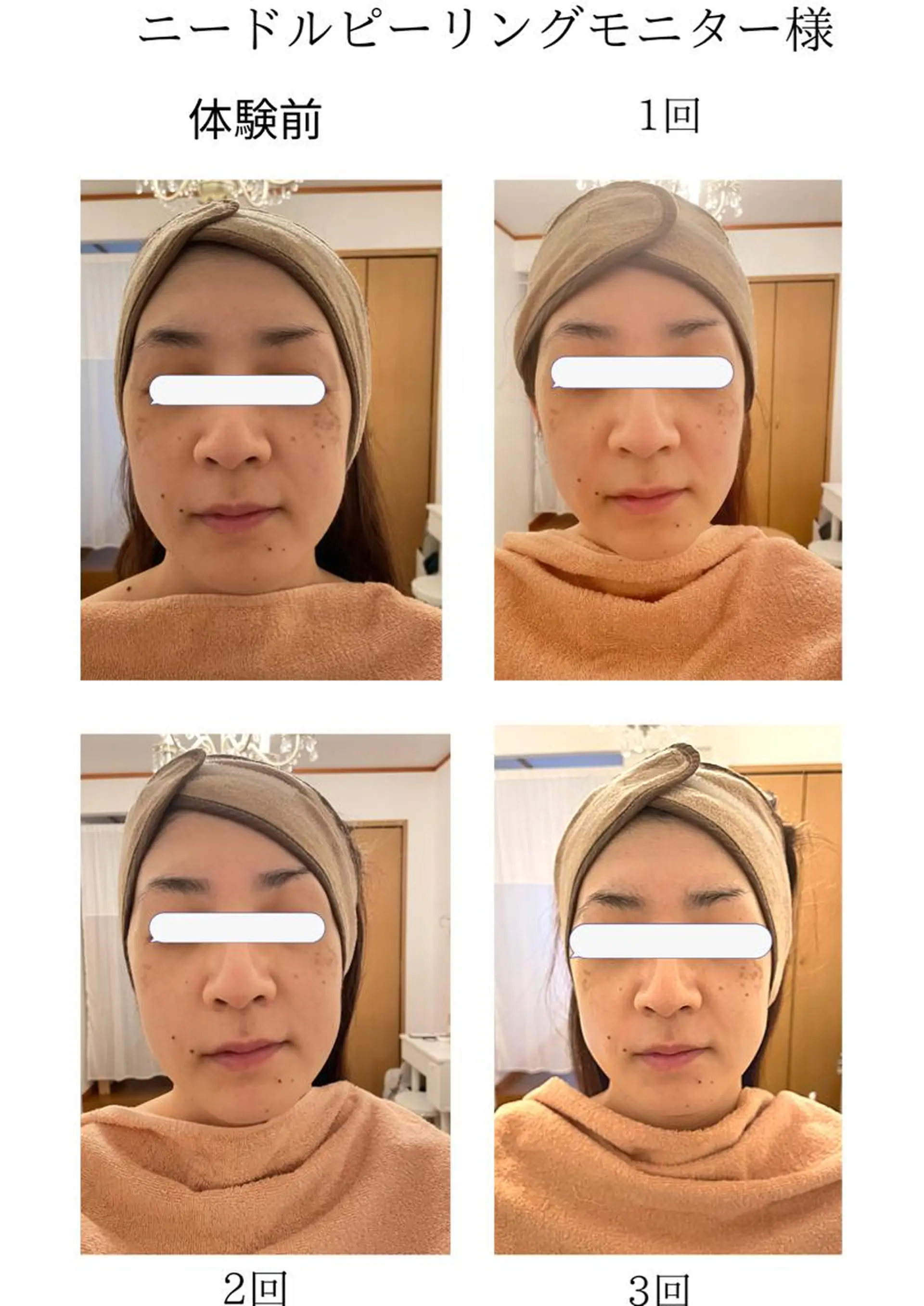 MA CHÉRIE所属・体質別痩身&小顔 MA CHÉRIEのエステ・リラクイメージ