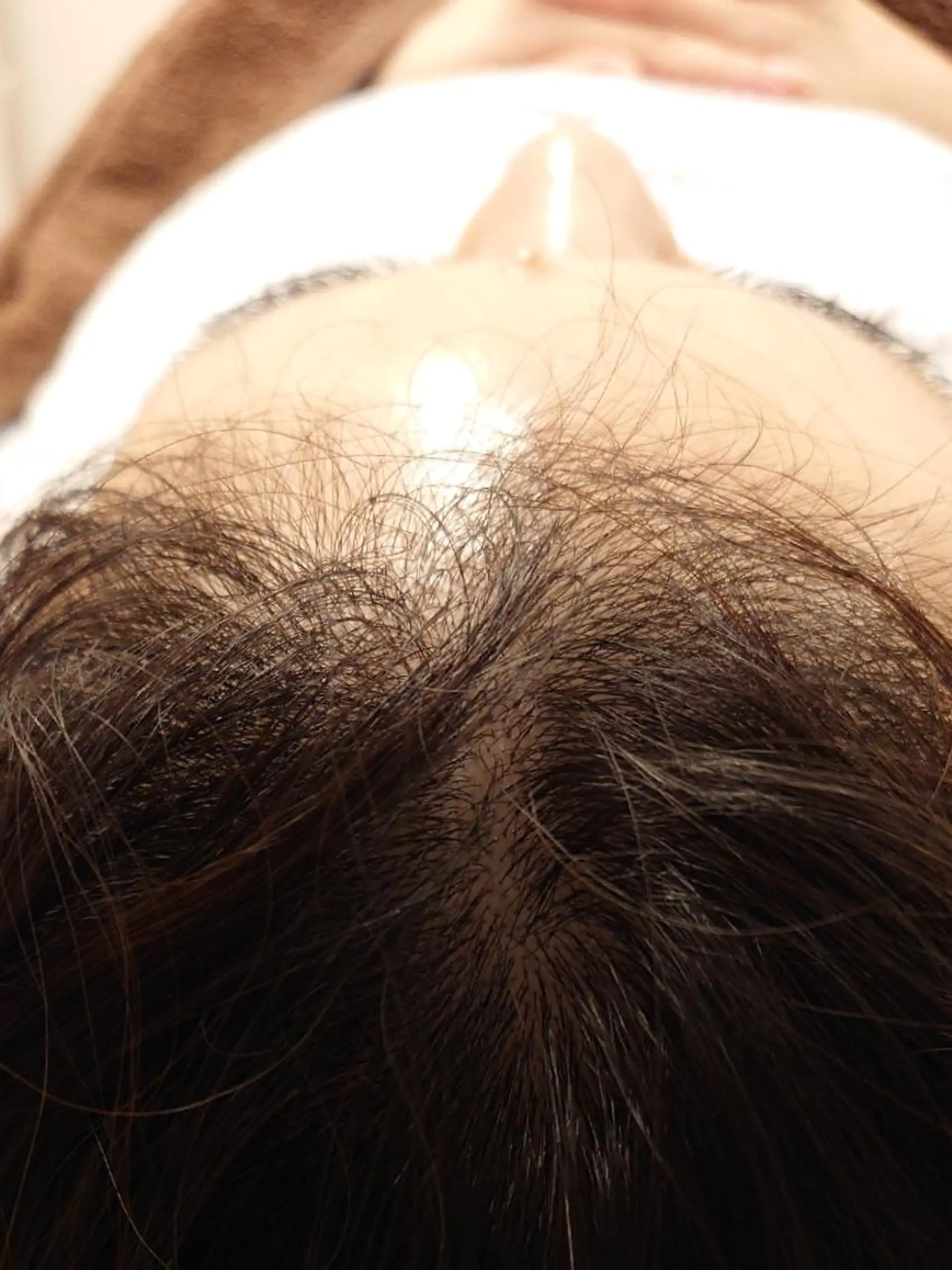 北梅田美容鍼灸院所属・美容鍼マイスター 川村　淳のエステ・リラクイメージ