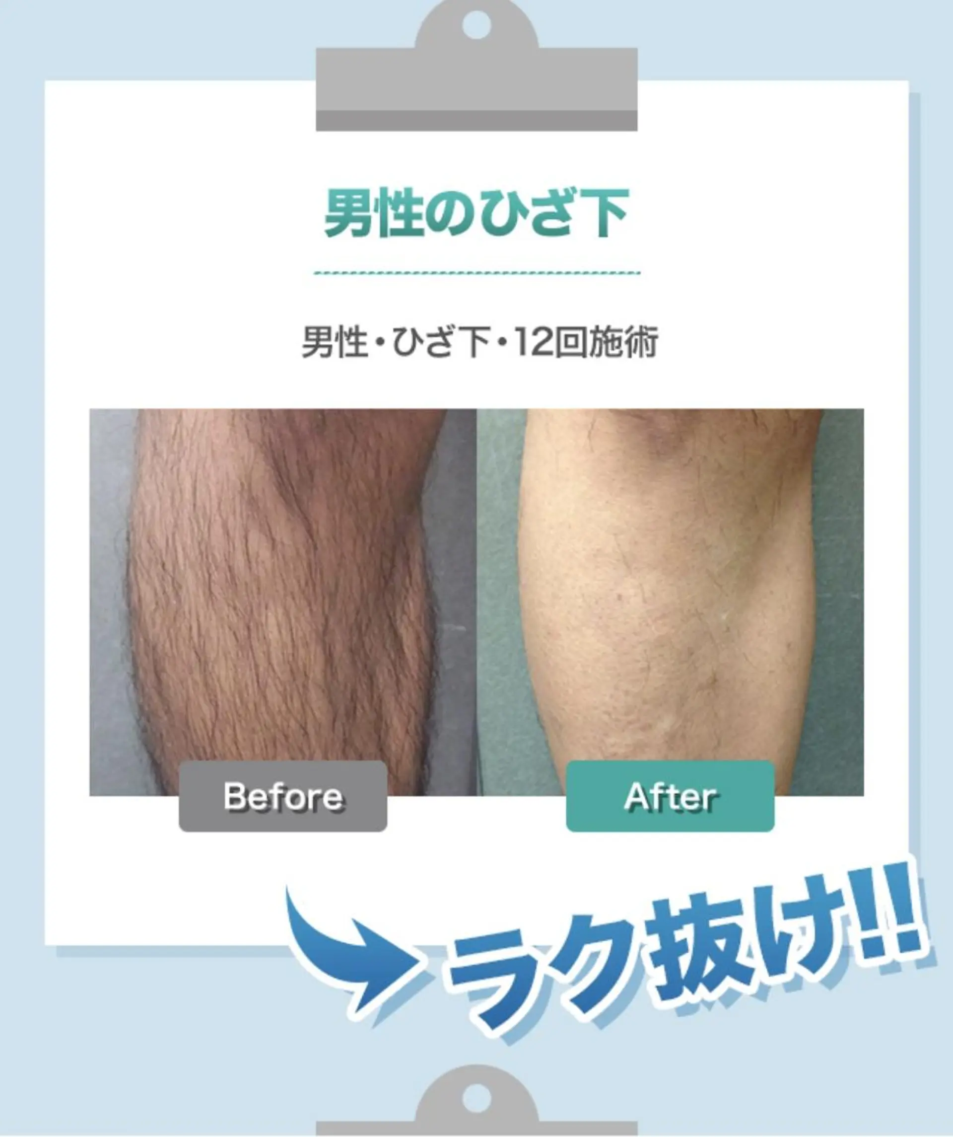 脱毛サロン y0uのエステ・リラクイメージ