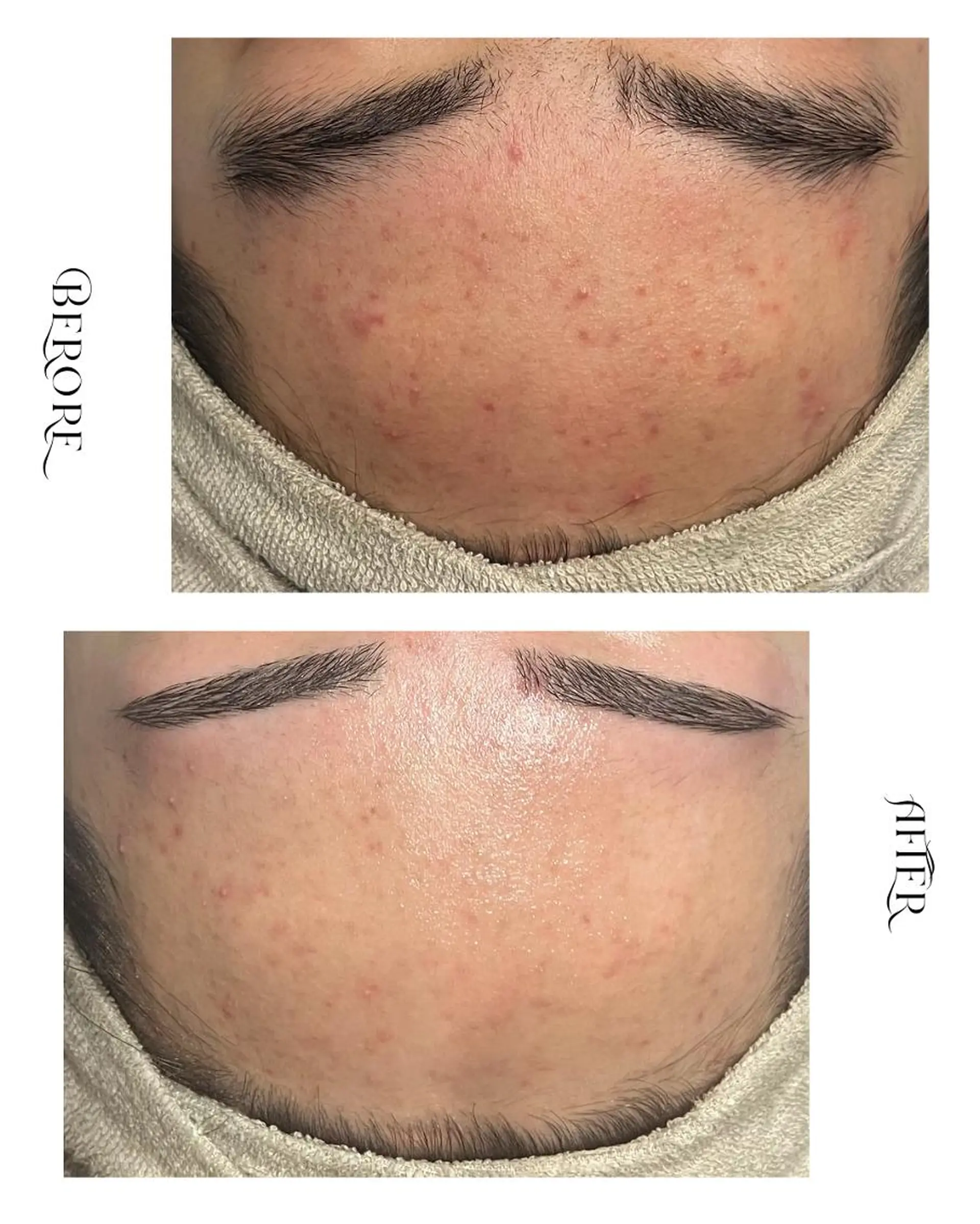 脱毛・肌質改善サロン Linoのエステ・リラクイメージ