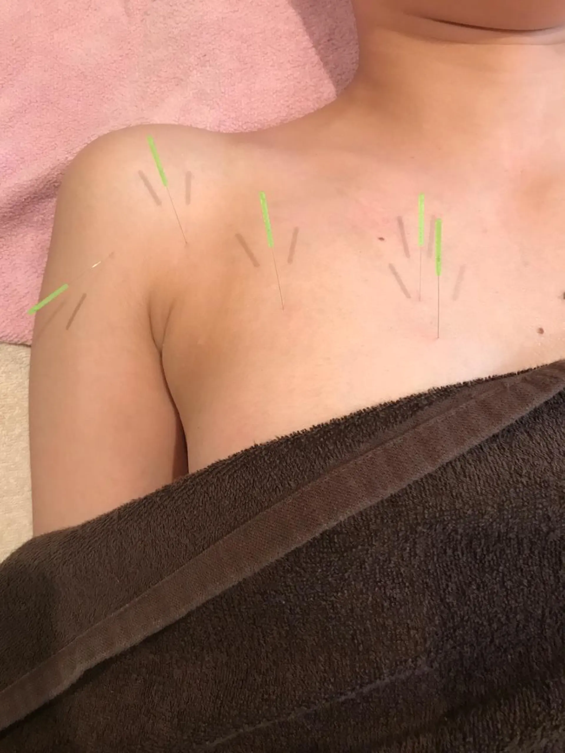 エステ リラク 美容鍼灸サロンYOSHINO所属・美容鍼灸サロン YOSHINOのエステ・リラクイメージ