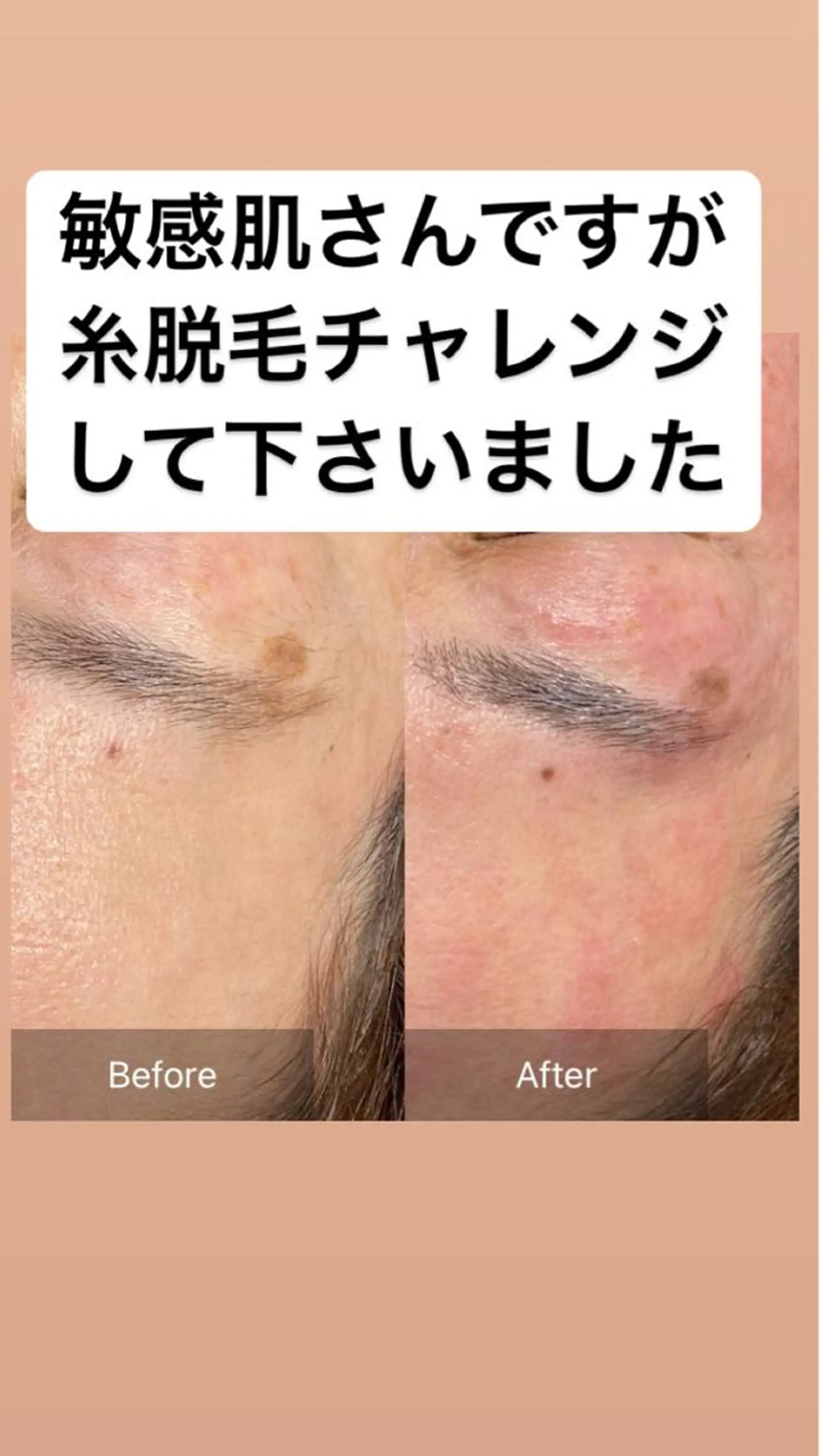 エステ 産毛専門店 Bittoのエステ・リラクイメージ