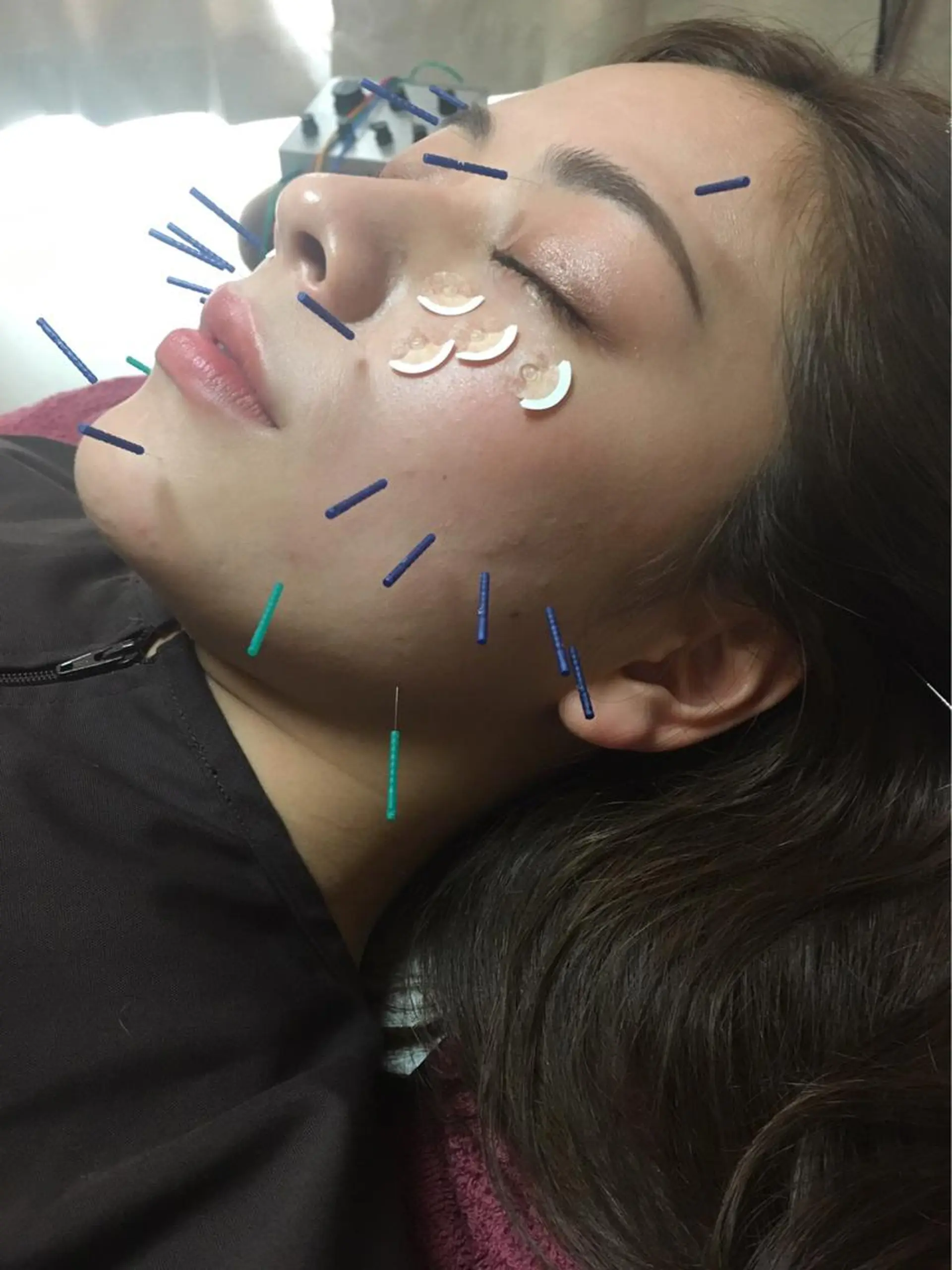 美容鍼灸女性専用 りんご鍼灸治療院のエステ・リラクイメージ