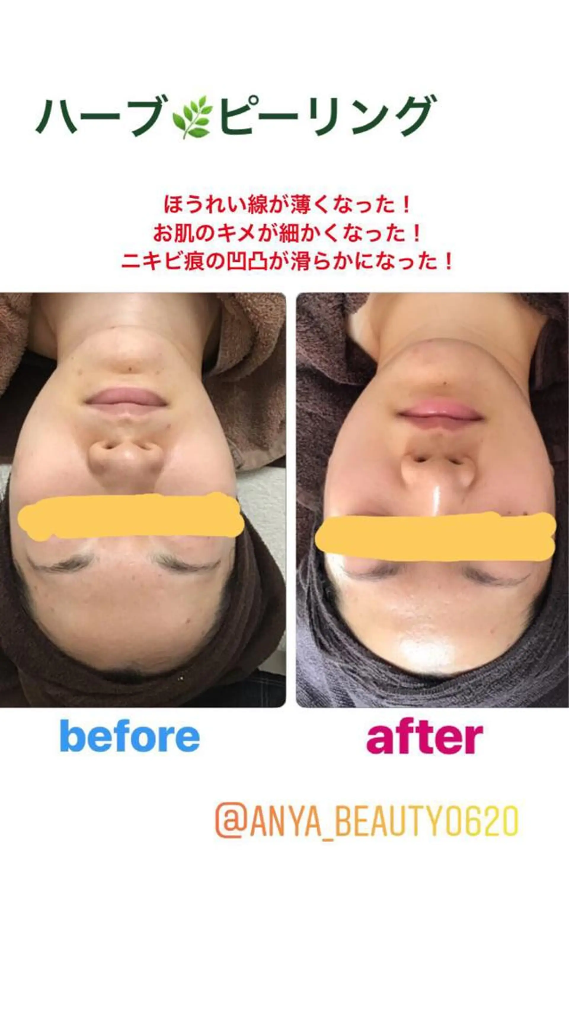 エステ リラク Anya Beautyのエステ・リラクイメージ