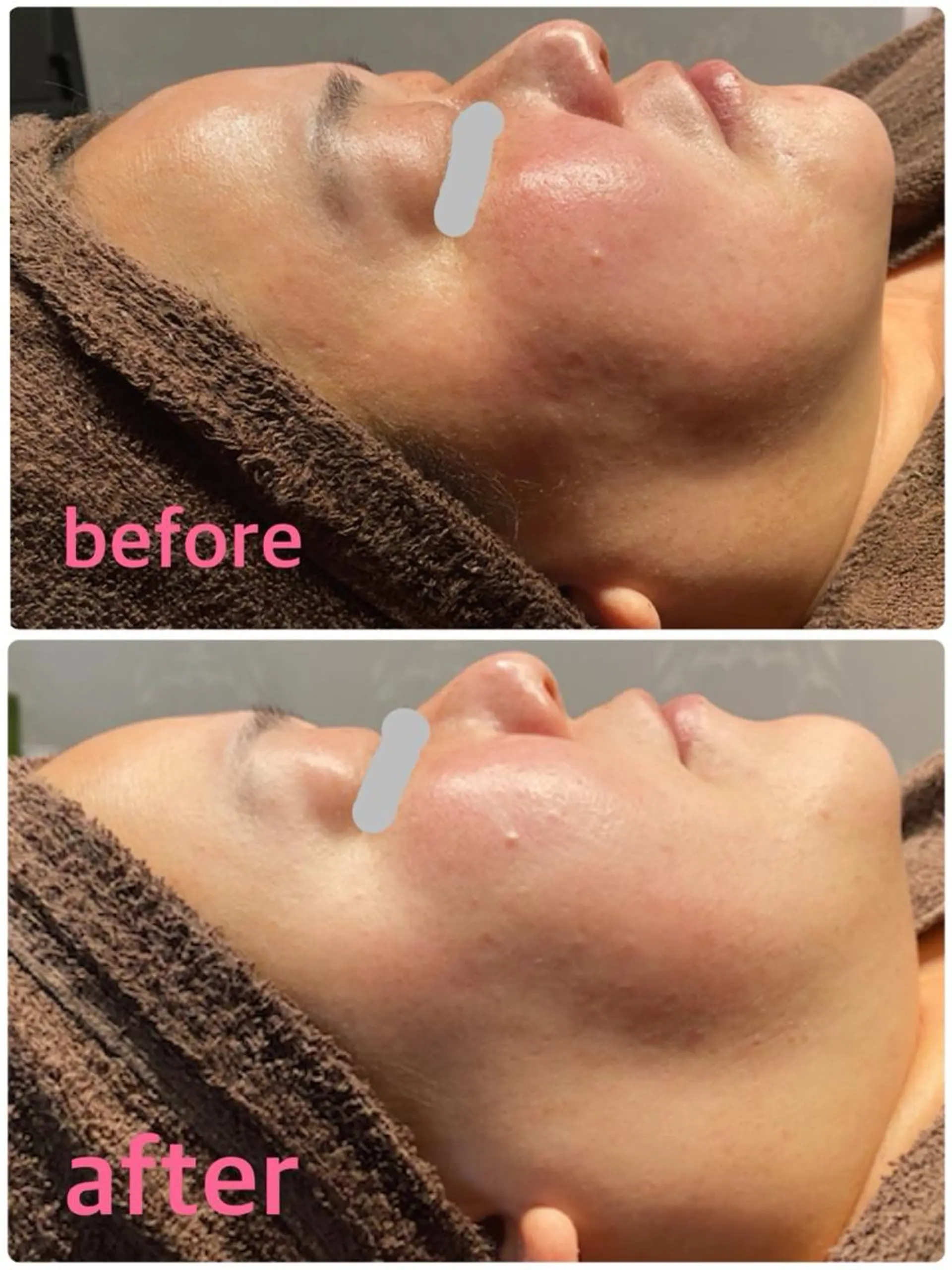 エステ twobeauty所属・twobeauty トゥービューティのエステ・リラクイメージ