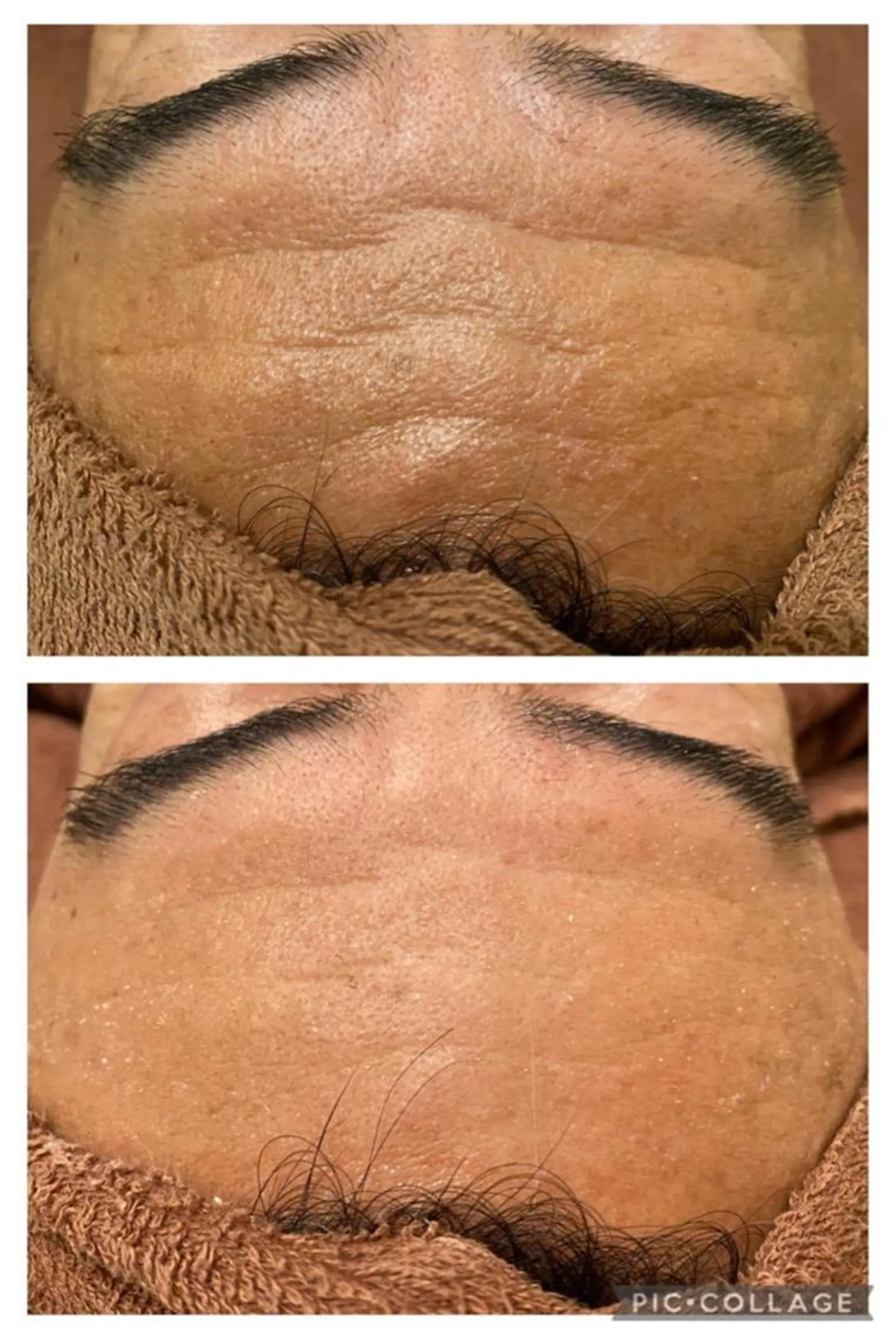 夏までに肌荒れ卒業 するサロン🌻のエステ・リラクイメージ