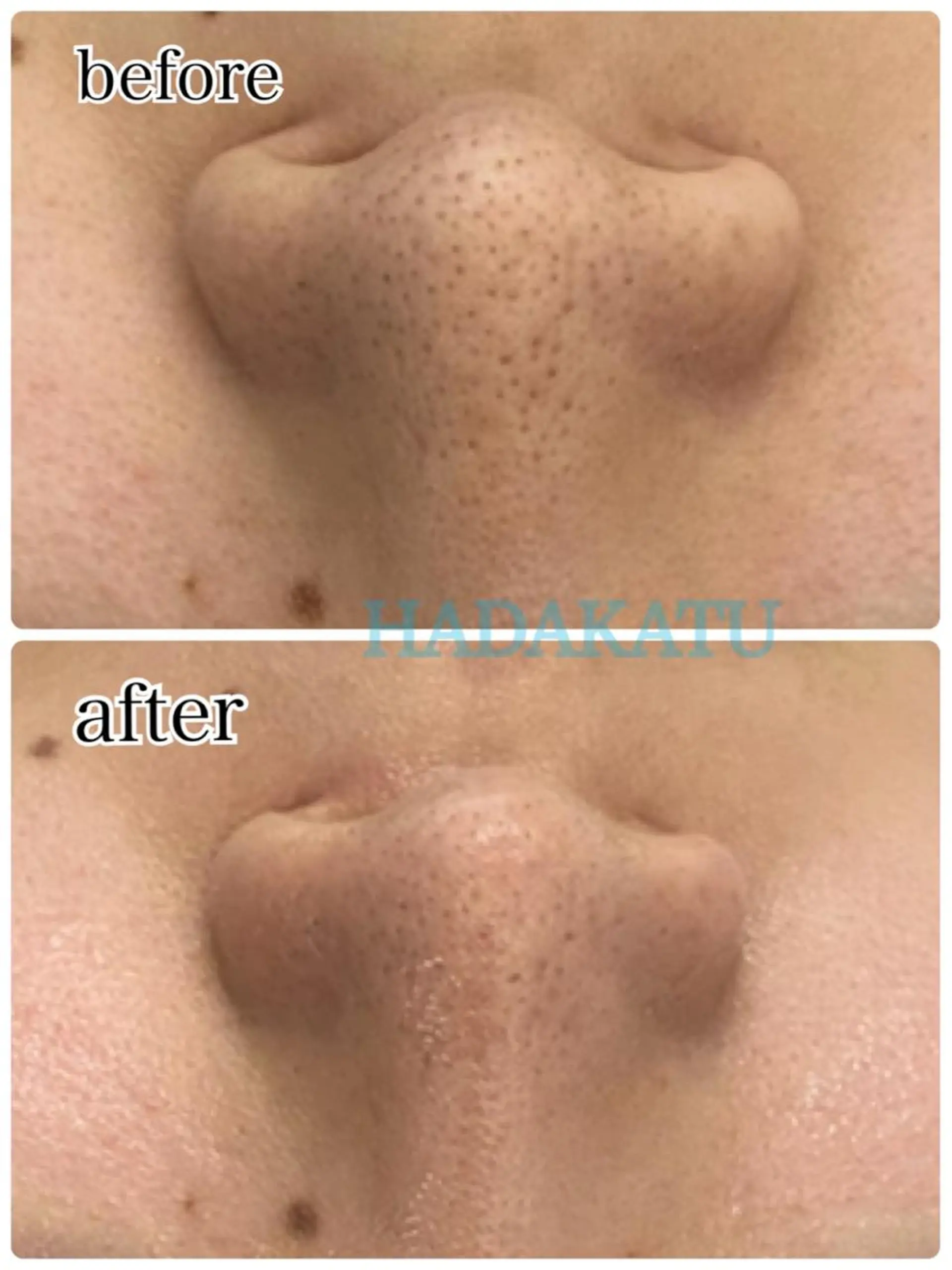 エステ 総合エステサロン 肌活のエステ・リラクイメージ