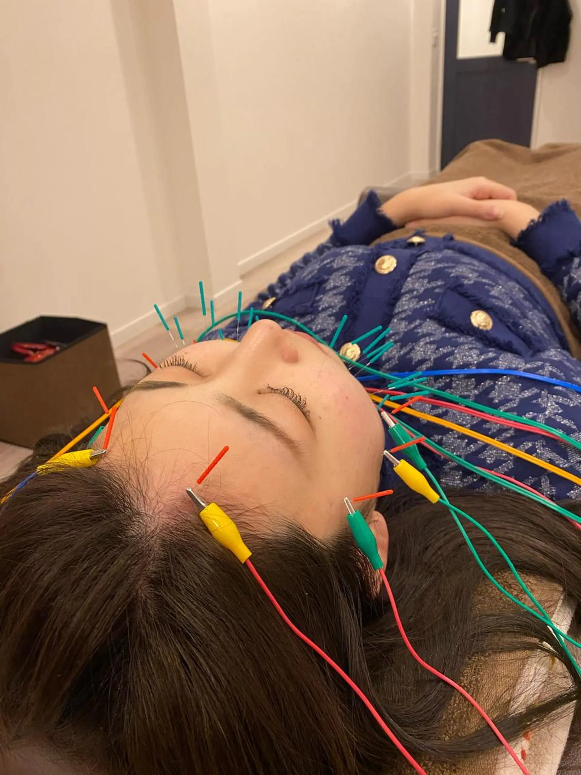 エステ リラク 美容鍼灸Solana所属・肌質改善×美容鍼 ゆいのエステ・リラクイメージ