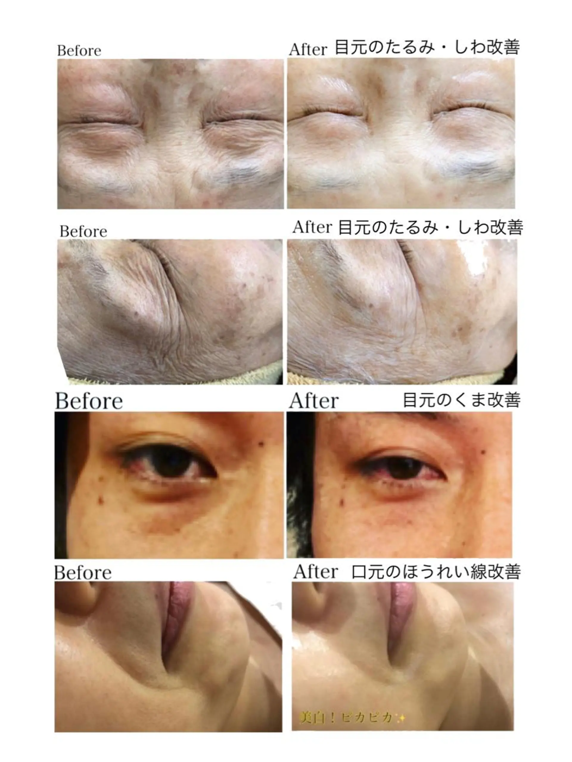 エステ リラク ES esthetiquesalon所属・Mano Amikaのエステ・リラクイメージ