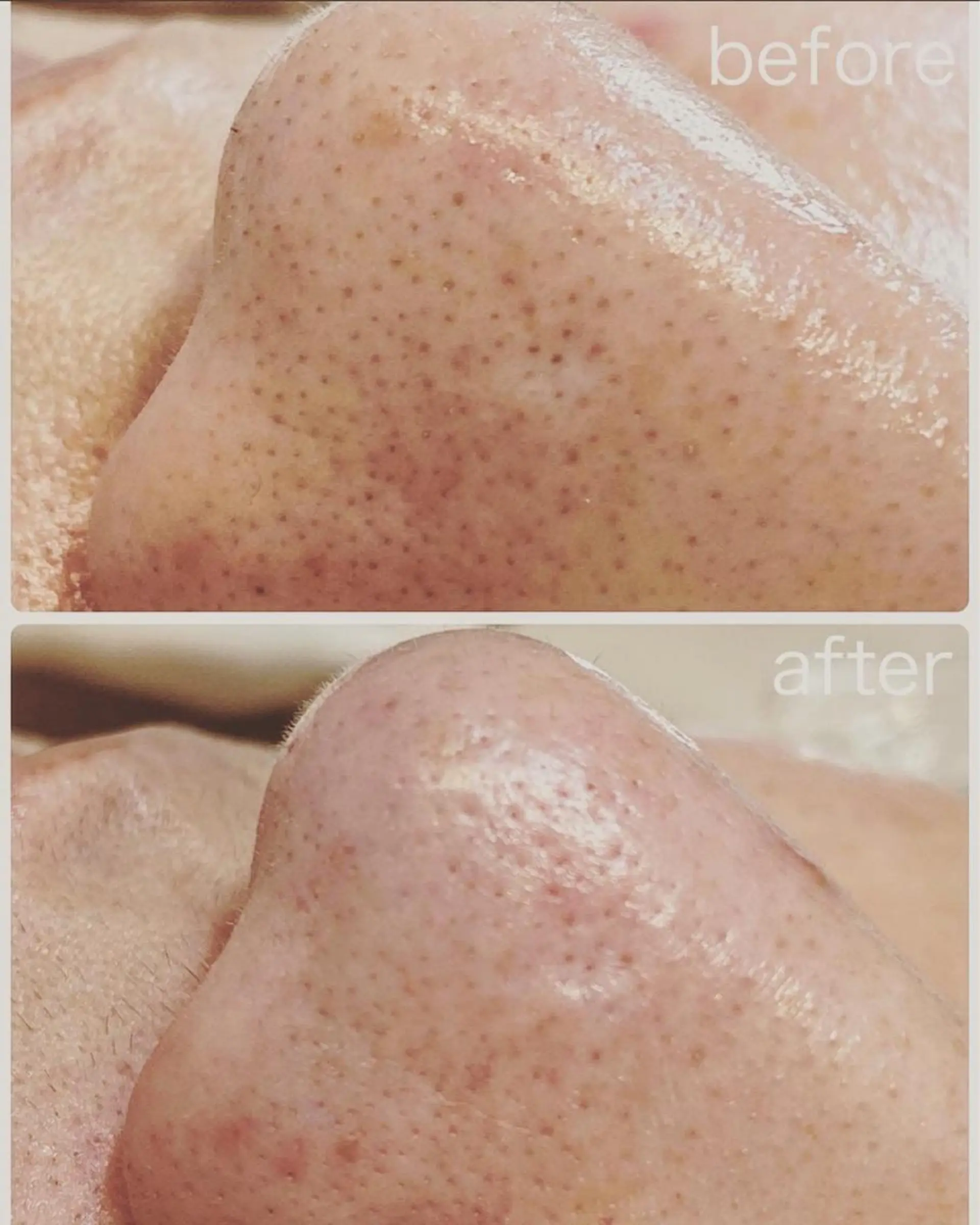 Lilld eyelash大井町のマツエク・マツパデザイン