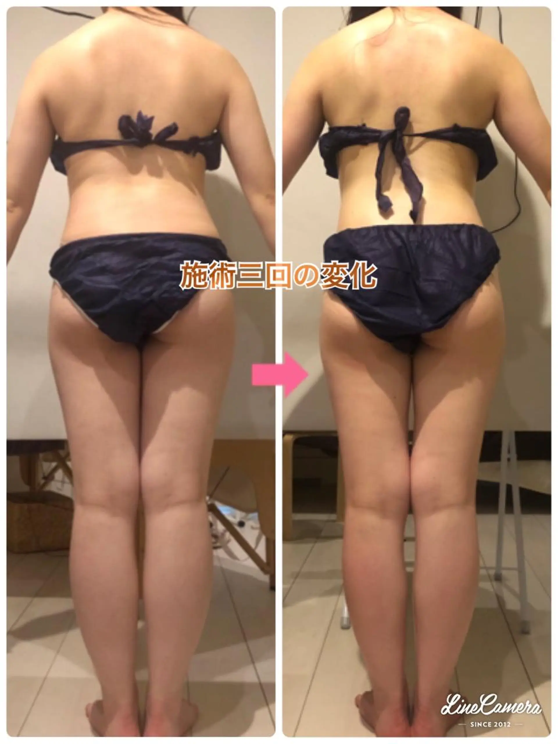 ショート カラー パーマ ヘアアレンジ メンズ キッズ ネイル マツエク・マツパ エステ リラク ‍痩身＆ボディ 結果出し🌟丹野のエステ・リラクイメージ