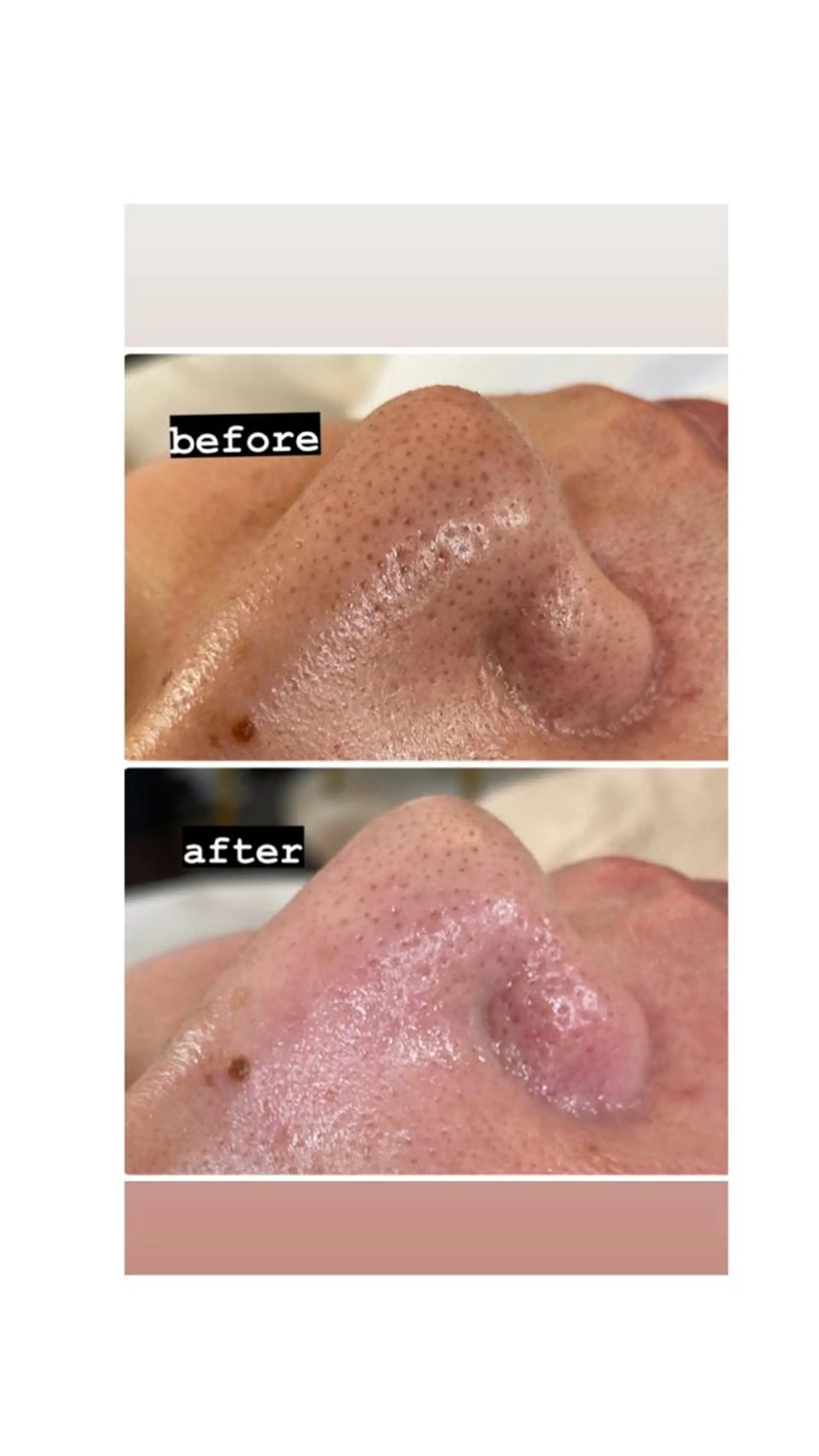 脱毛・エステサロン LuLuNのエステ・リラクイメージ