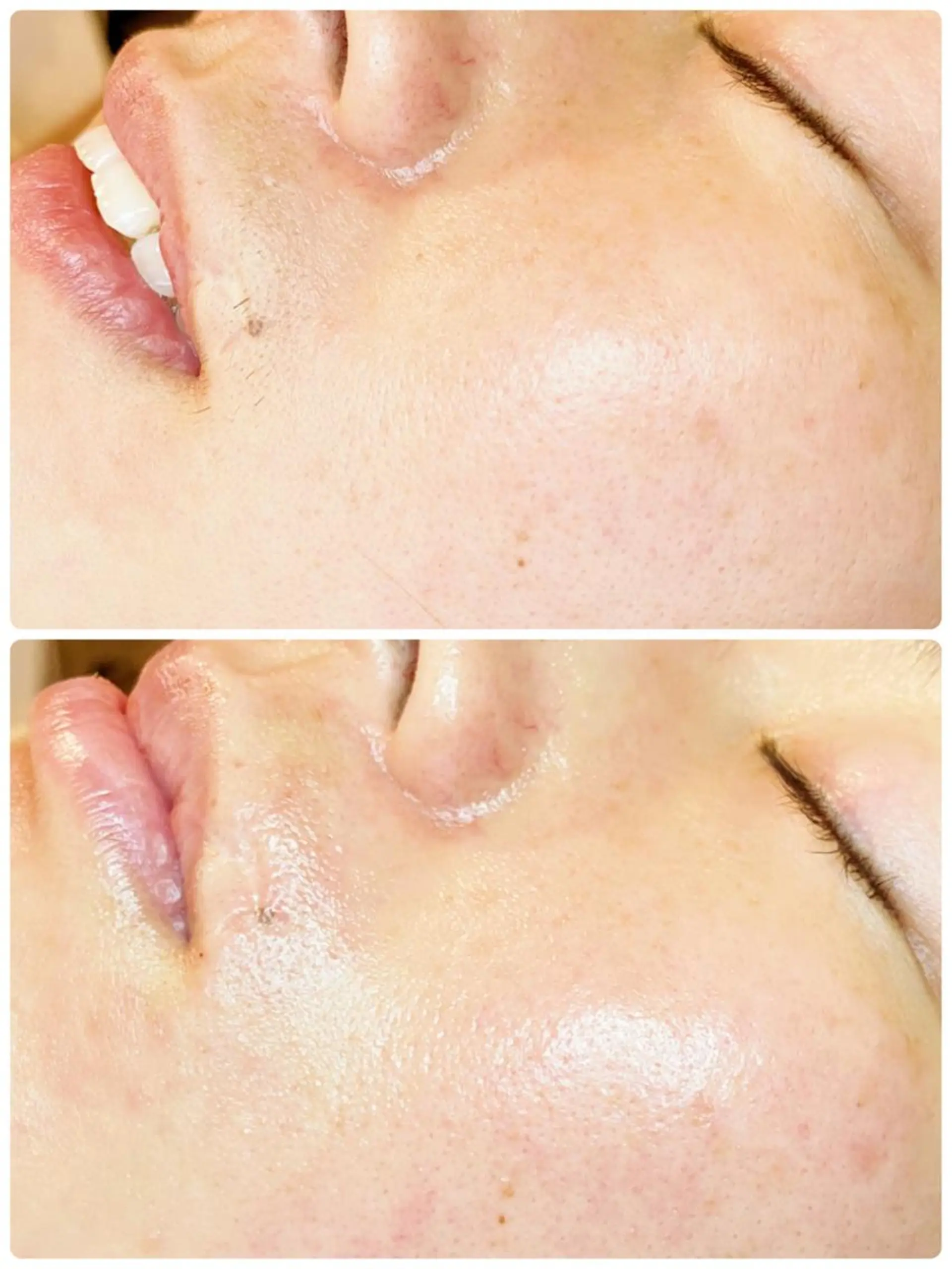 多摩境Beauty Salon  ViVi所属・多摩境ViVi chinamiのエステ・リラクイメージ