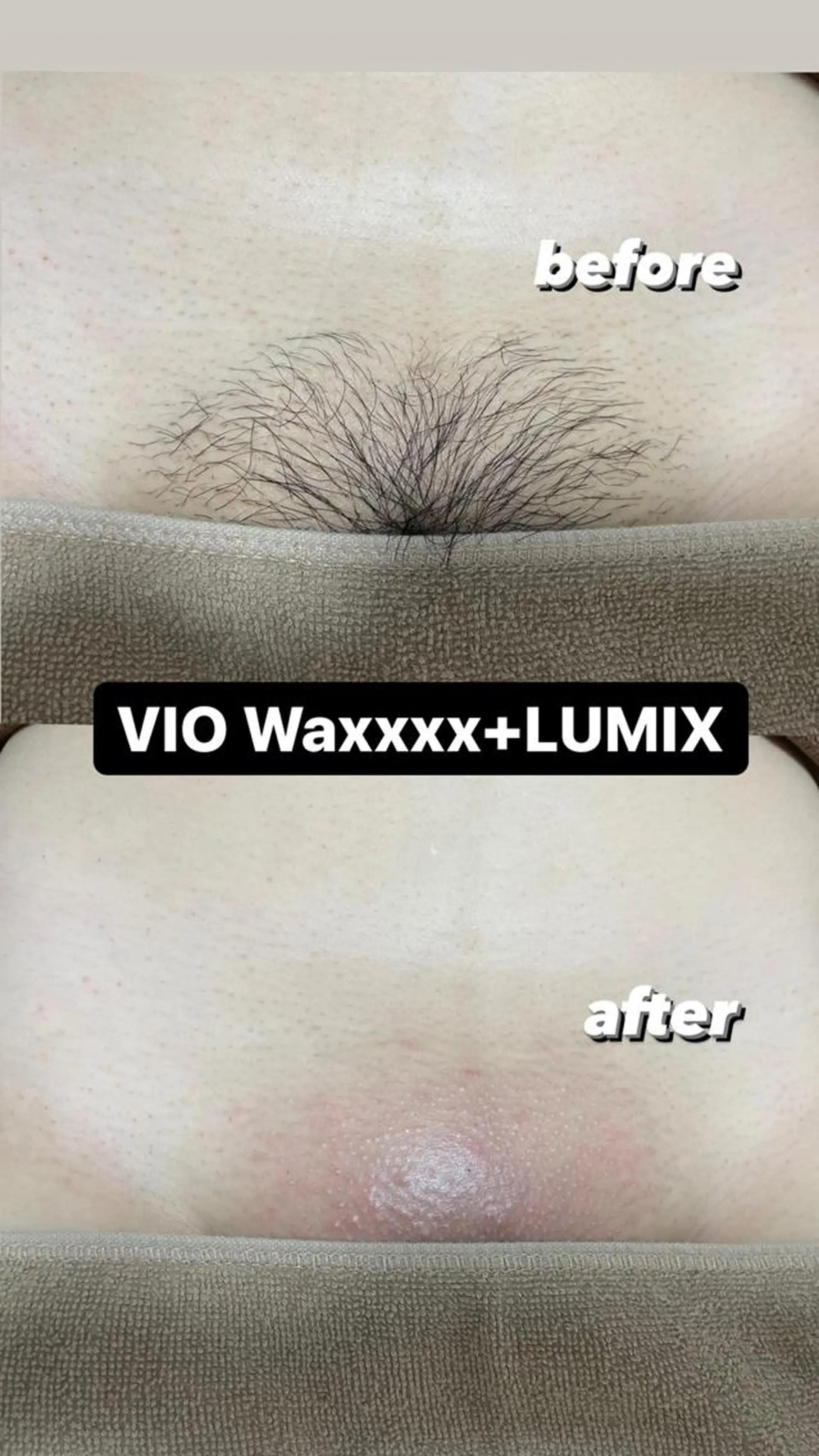 メンズ 脱毛 Epina 千葉店 【エピナ】のエステ・リラクイメージ