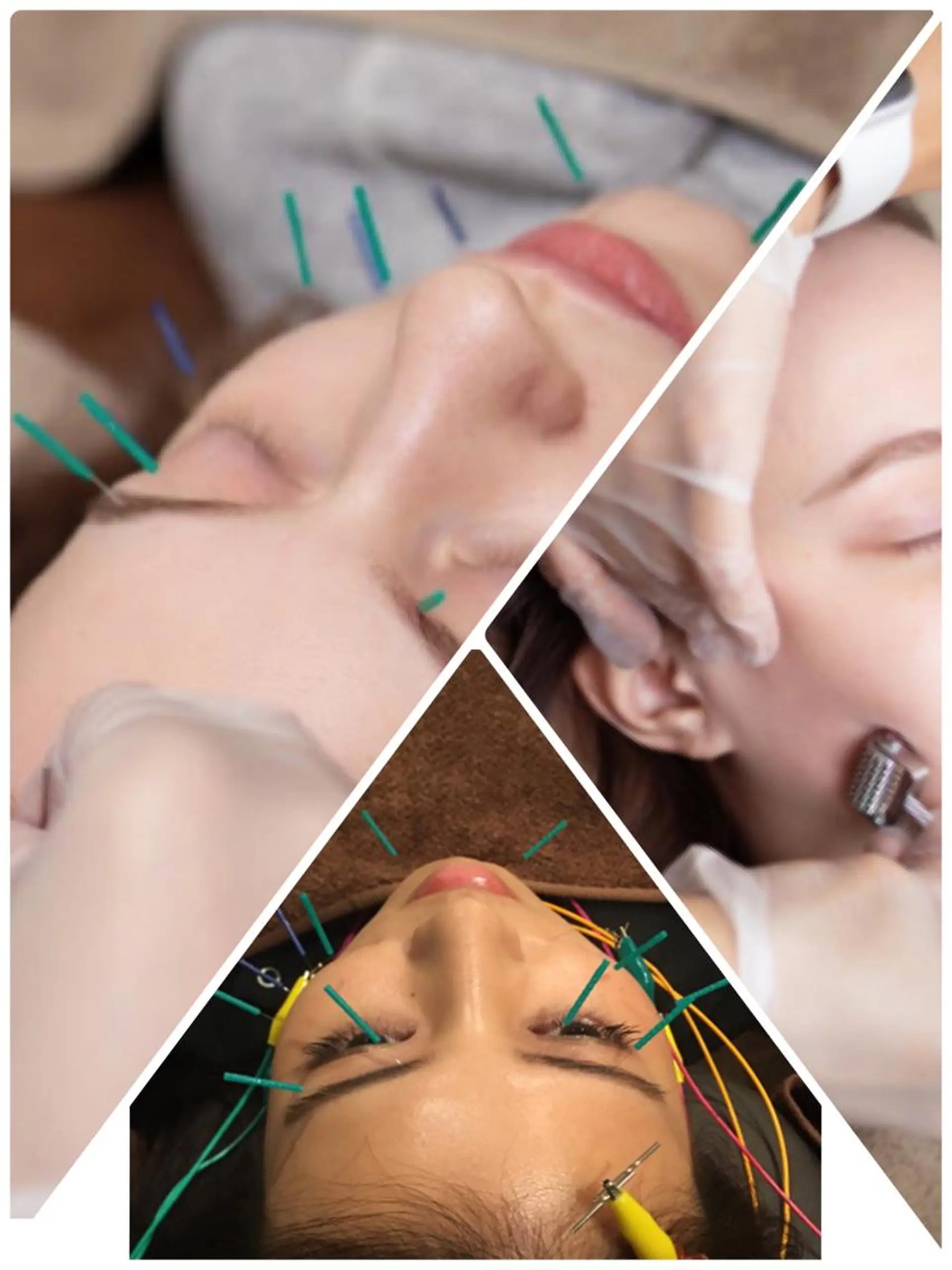 表参道鍼灸院K 美容鍼🔮ララピールのエステ・リラクイメージ