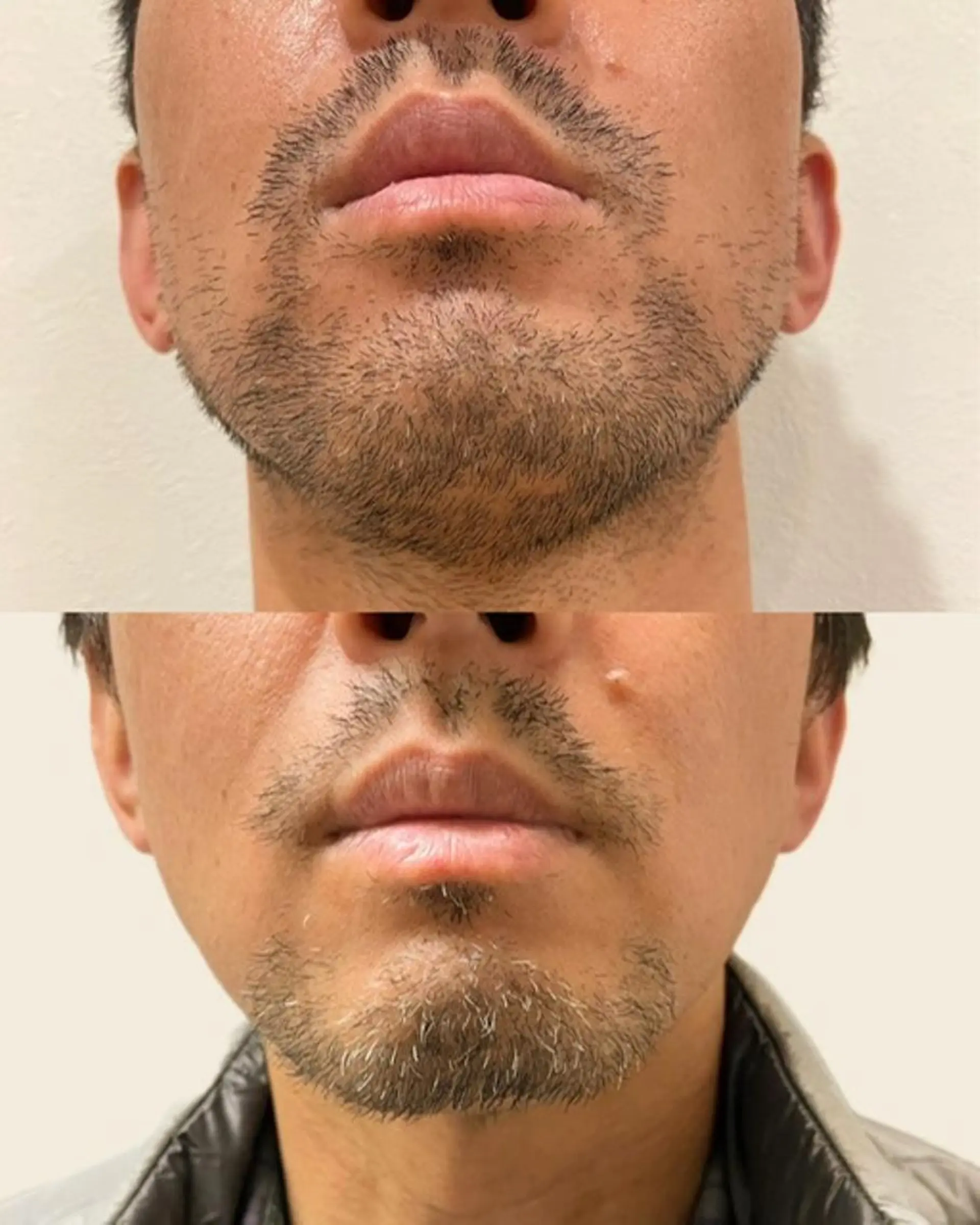 メンズ 脱毛 メンズビューティー 池村哲雄のエステ・リラクイメージ