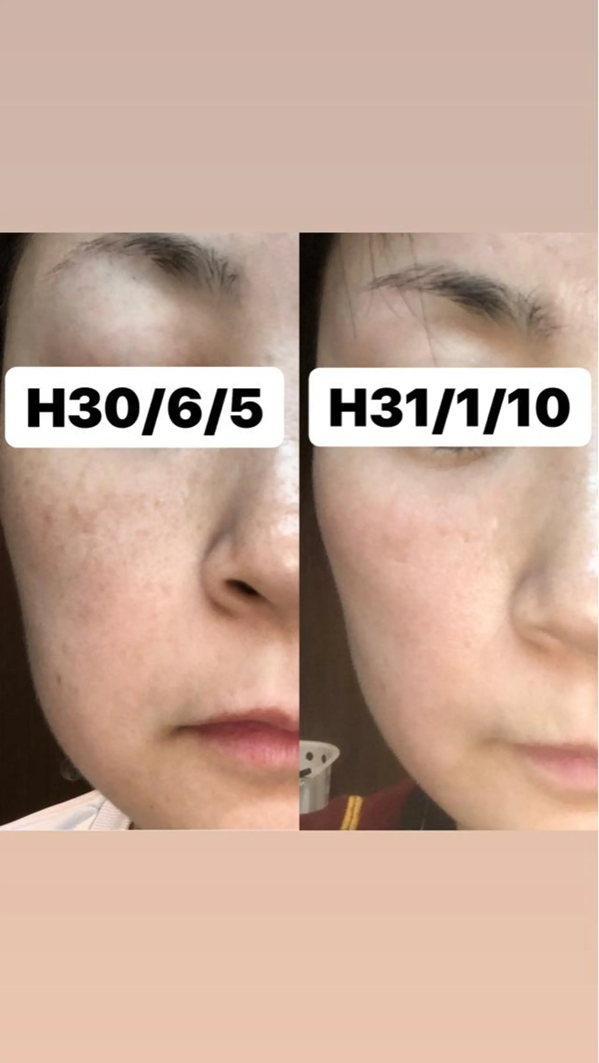 エステ Shiny所属・✨ナリス化粧品✨ Shinyのエステ・リラクイメージ