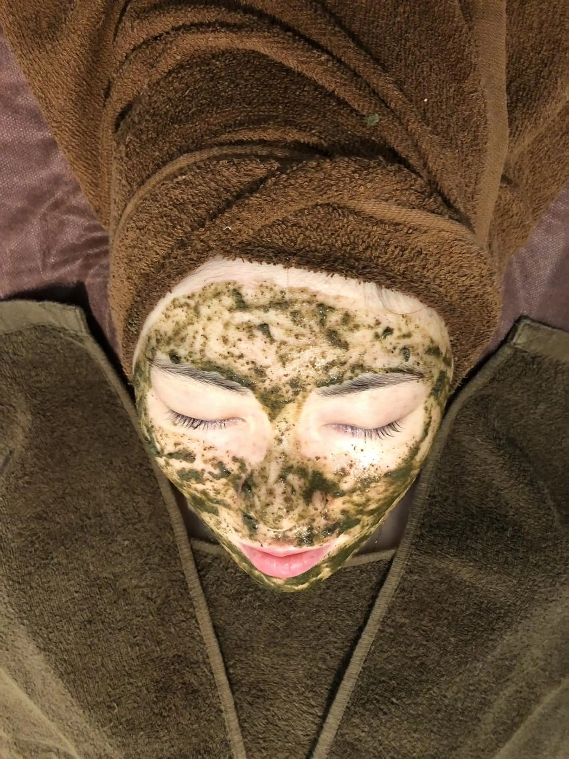 エステ 美容鍼灸整体サロンBeauJu所属・小顔矯/美容鍼/鍼灸 BeauJuのその他イメージ