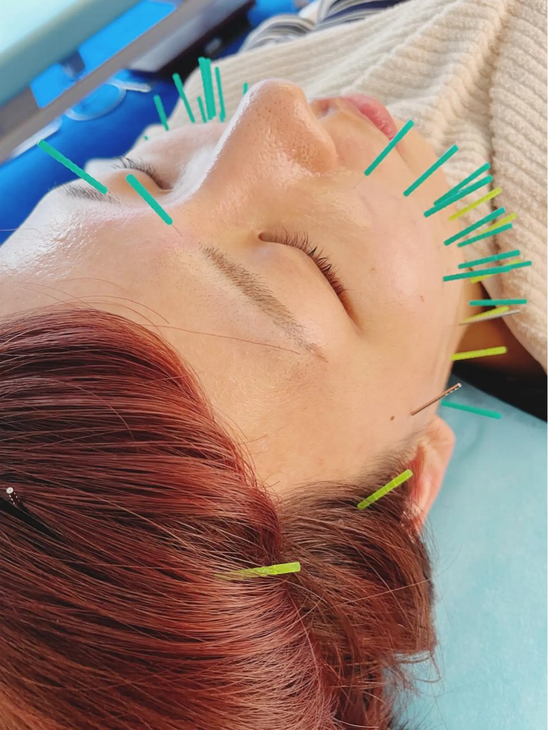 小顔美容鍼専門サロン 渋谷YZのエステ・リラクイメージ