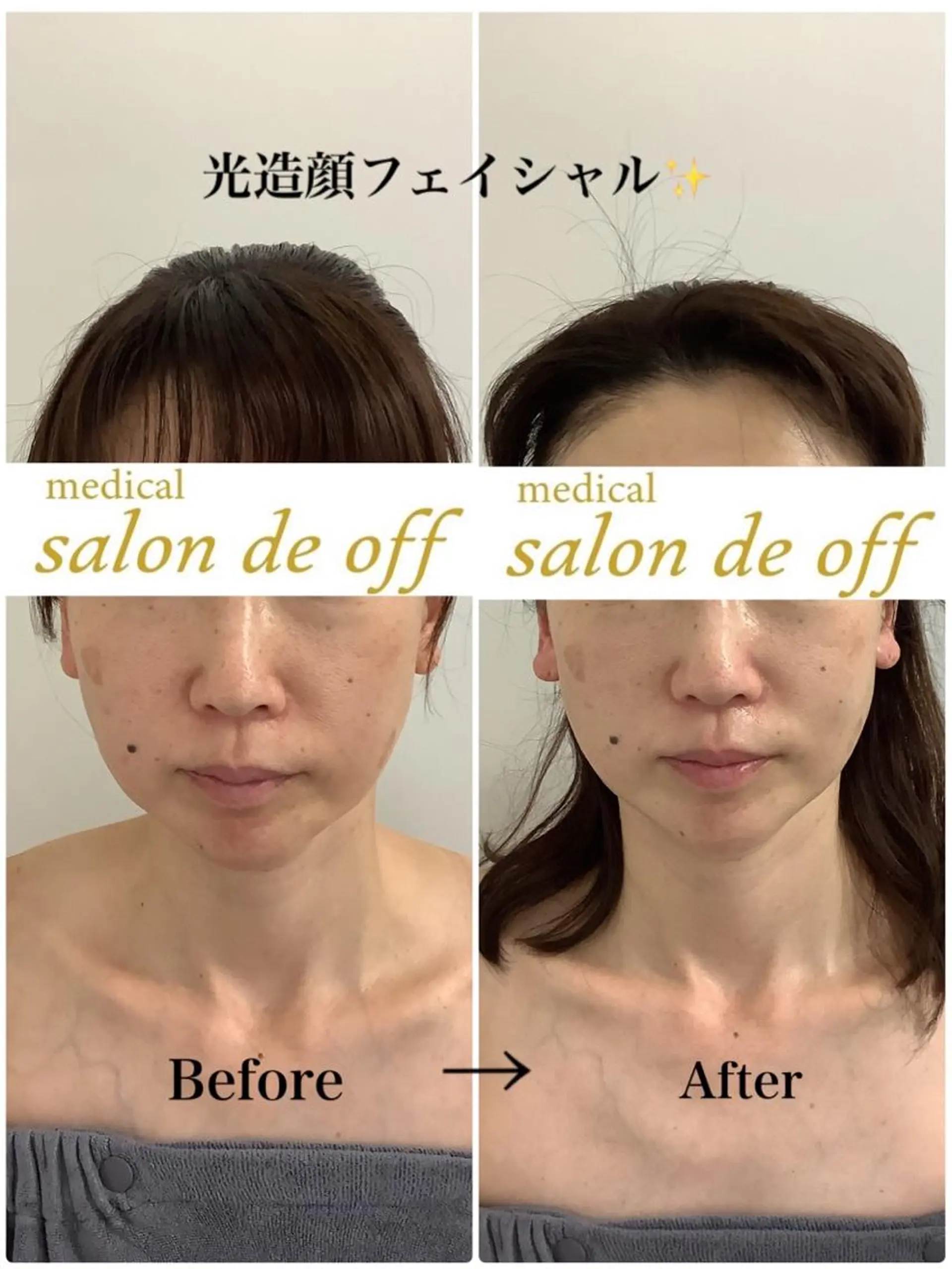 🩵Tatsumi Kana🩵のエステ・リラクイメージ