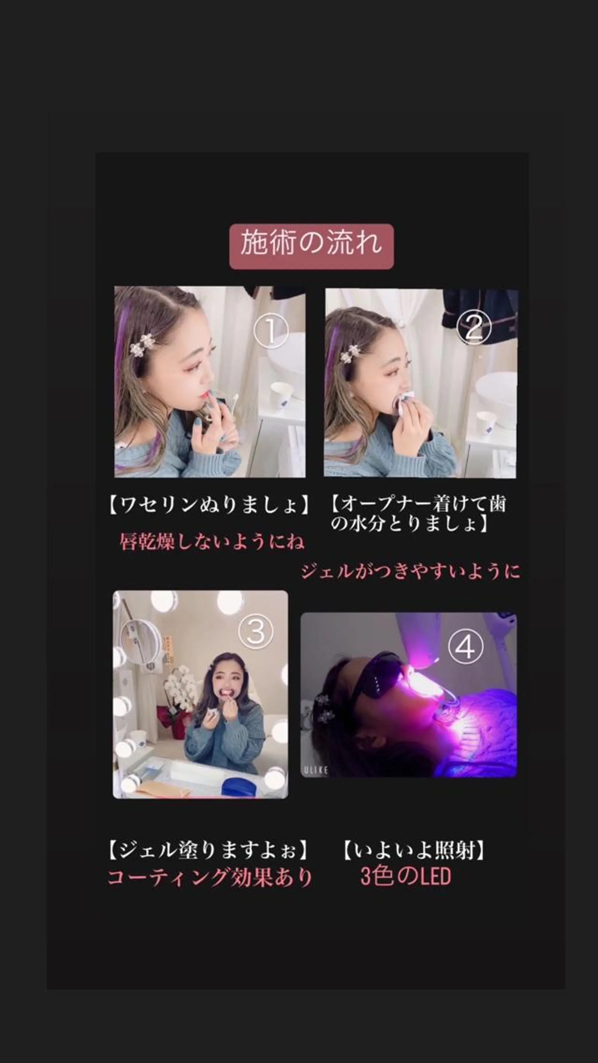 ホワイトニングビューティー松戸店所属・ホワイトニング ビューティー松戸店のその他イメージ