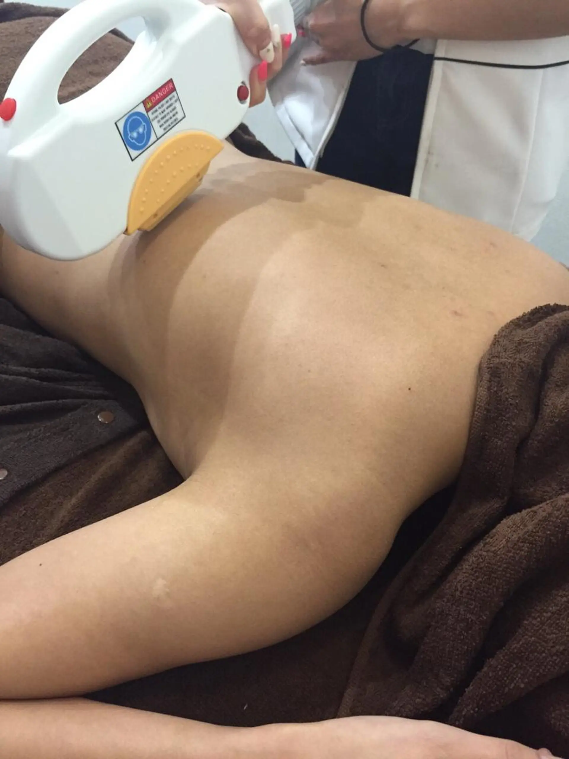 毛穴改善/脱毛 ネイル　川上久仁子のエステ・リラクイメージ