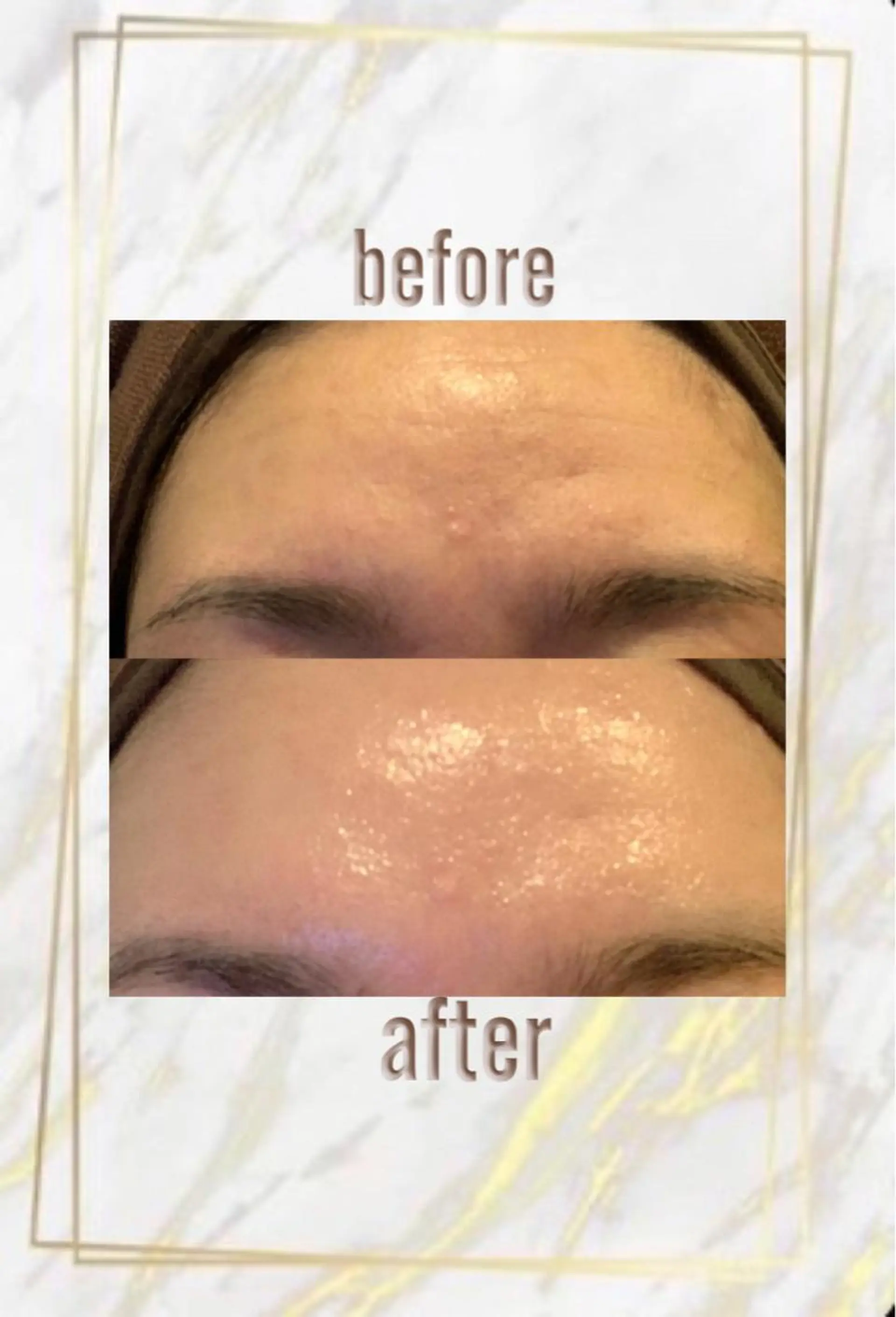 ハーブピーリング特選 認定rebirthのエステ・リラクイメージ