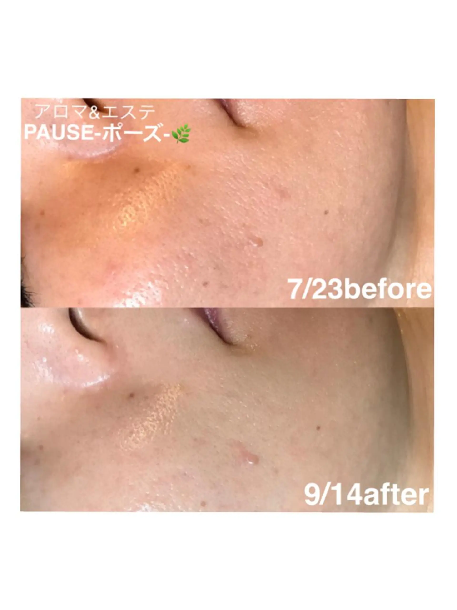 エステ 浜野 恵美のエステ・リラクイメージ