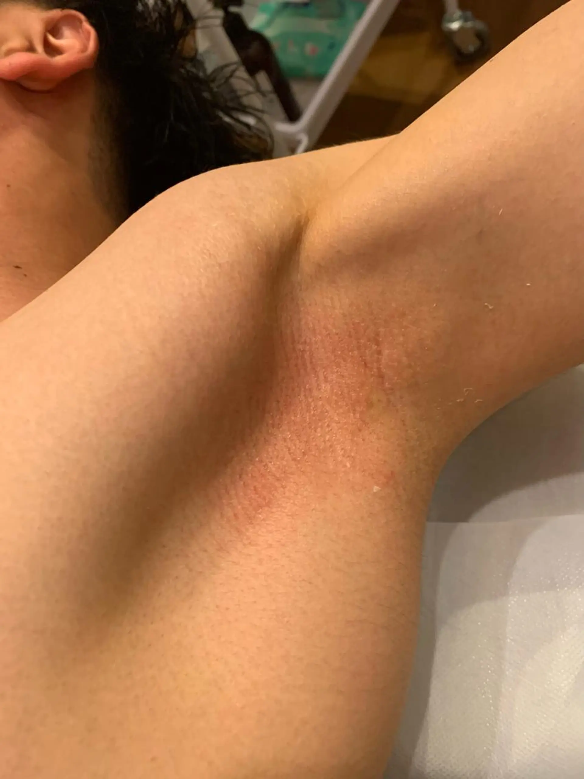 脱毛 Hisui 山本のエステ・リラクイメージ