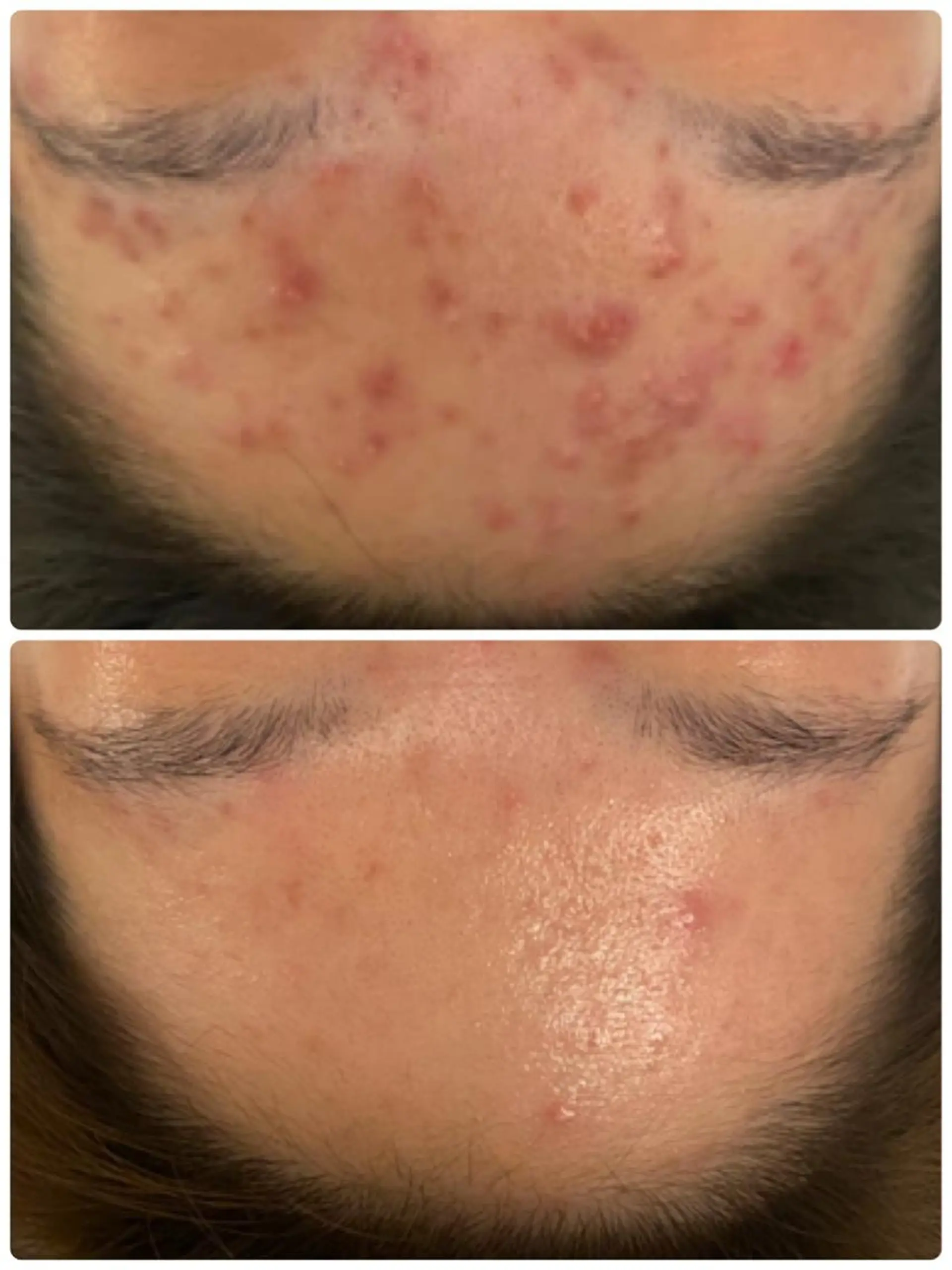 エステ フェイシャル専門 肌質改善/プランスのエステ・リラクイメージ