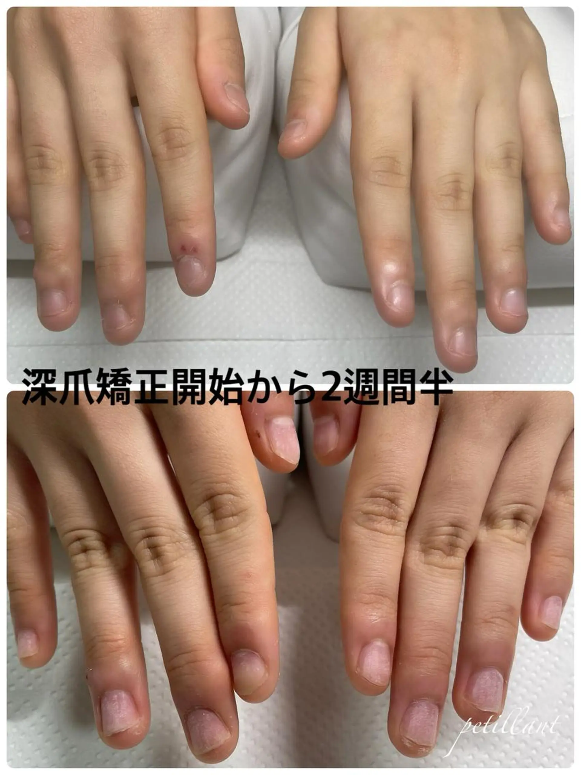 ネイル 長さ出し ピンク petillant所属・nail salon petillantのネイルデザイン