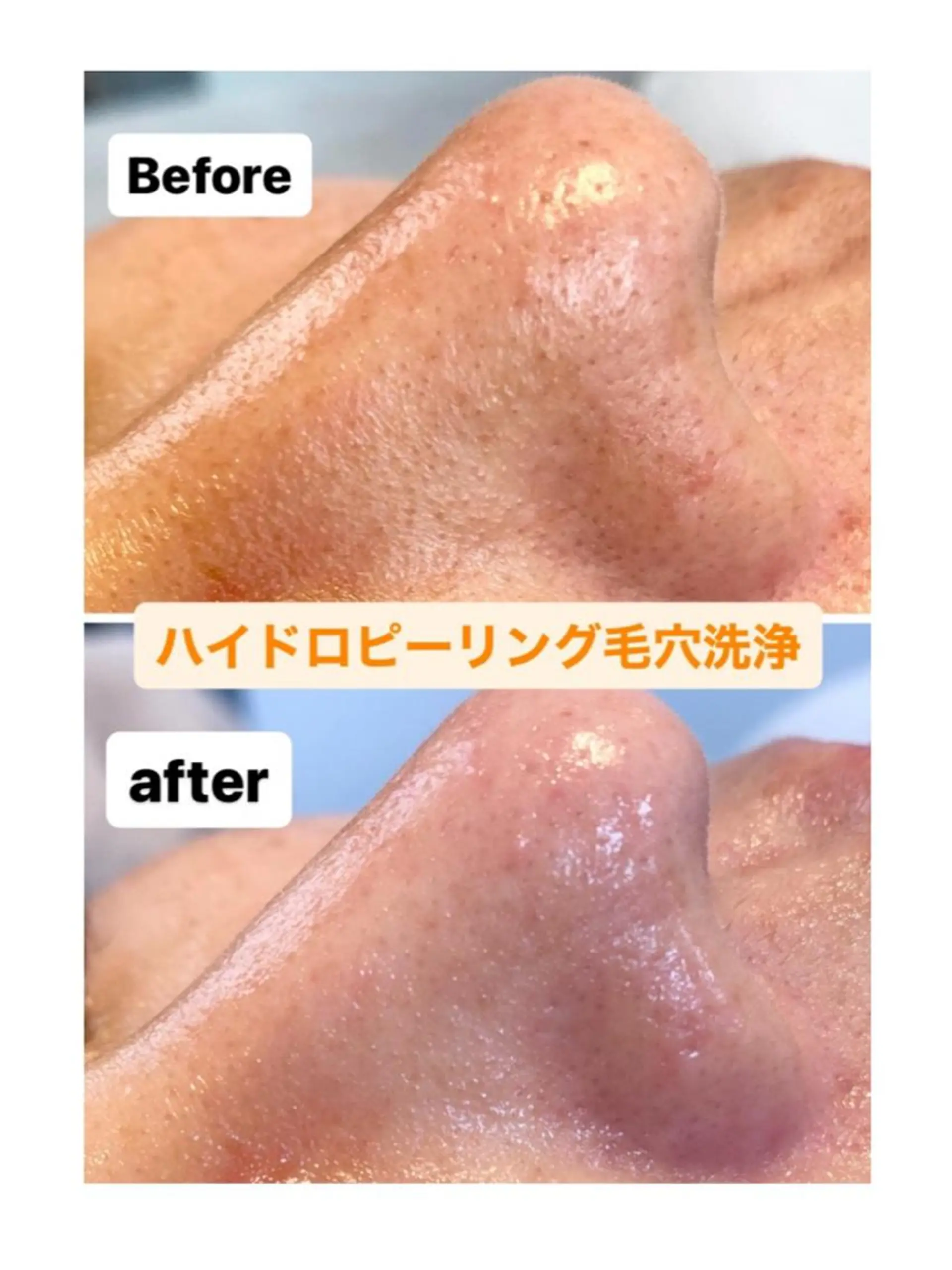 脱毛・エステサロン LuLuNのエステ・リラクイメージ