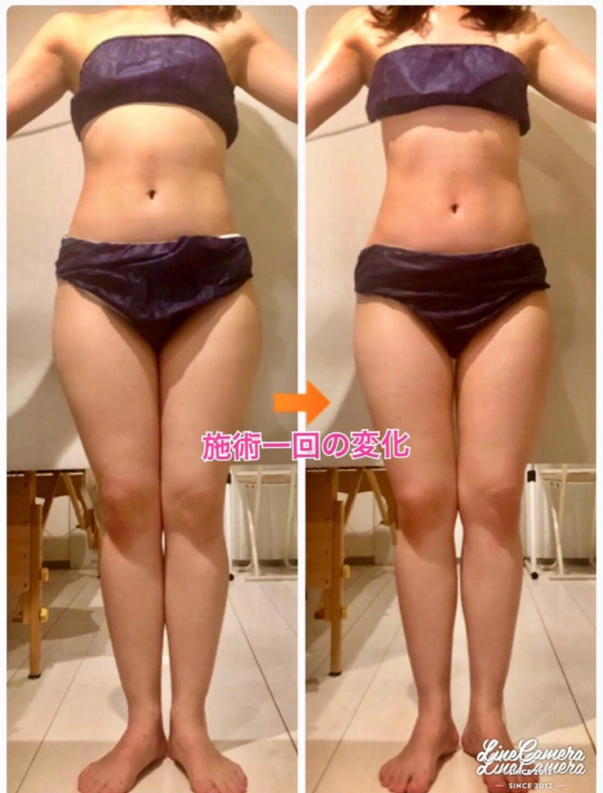 ショート カラー パーマ ヘアアレンジ メンズ キッズ ネイル マツエク・マツパ ‍痩身＆ボディ 結果出し🌟丹野のエステ・リラクイメージ