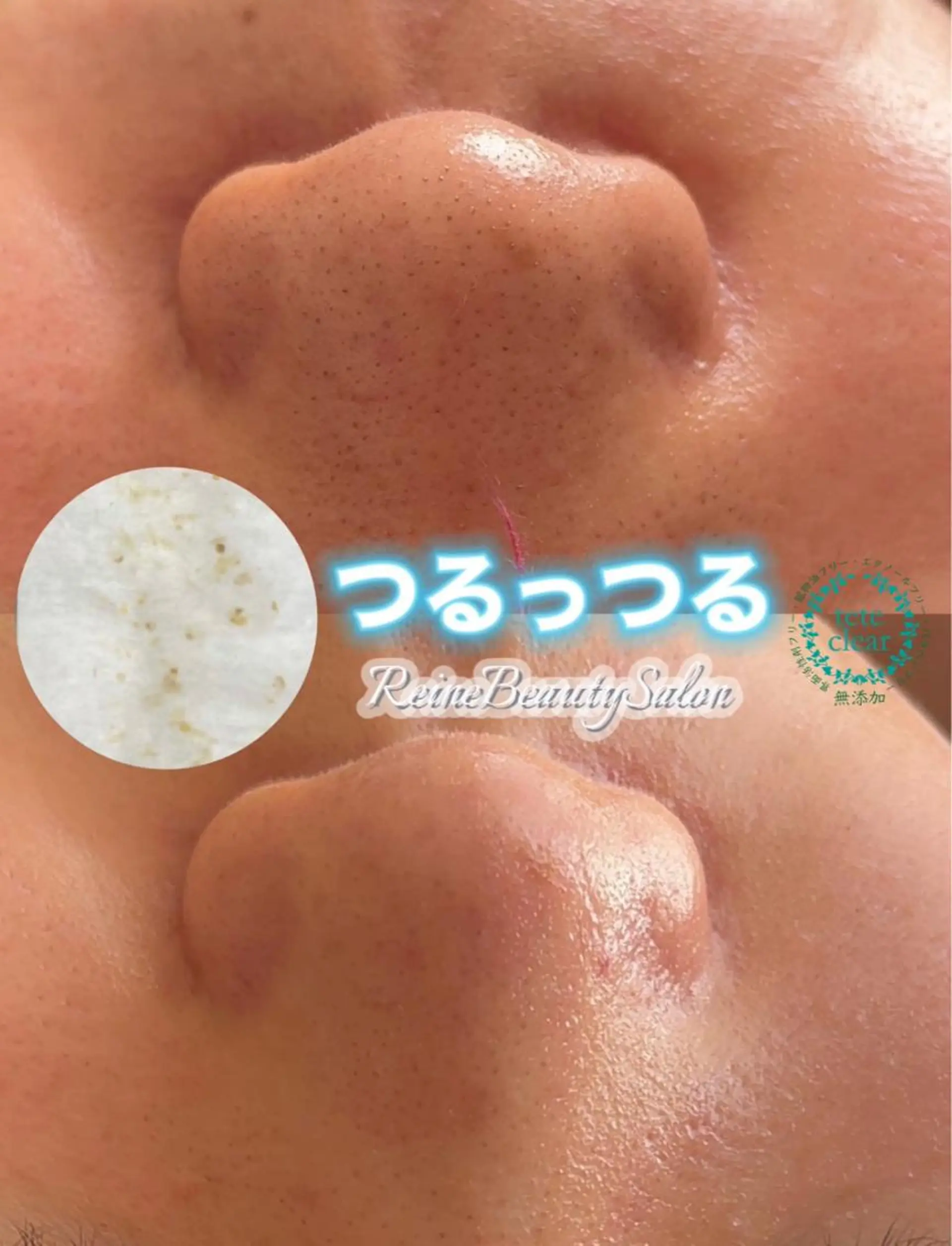 Reine BeautySalon所属・毛穴/シミ肝斑/脱毛 横山梨里のエステ・リラクイメージ