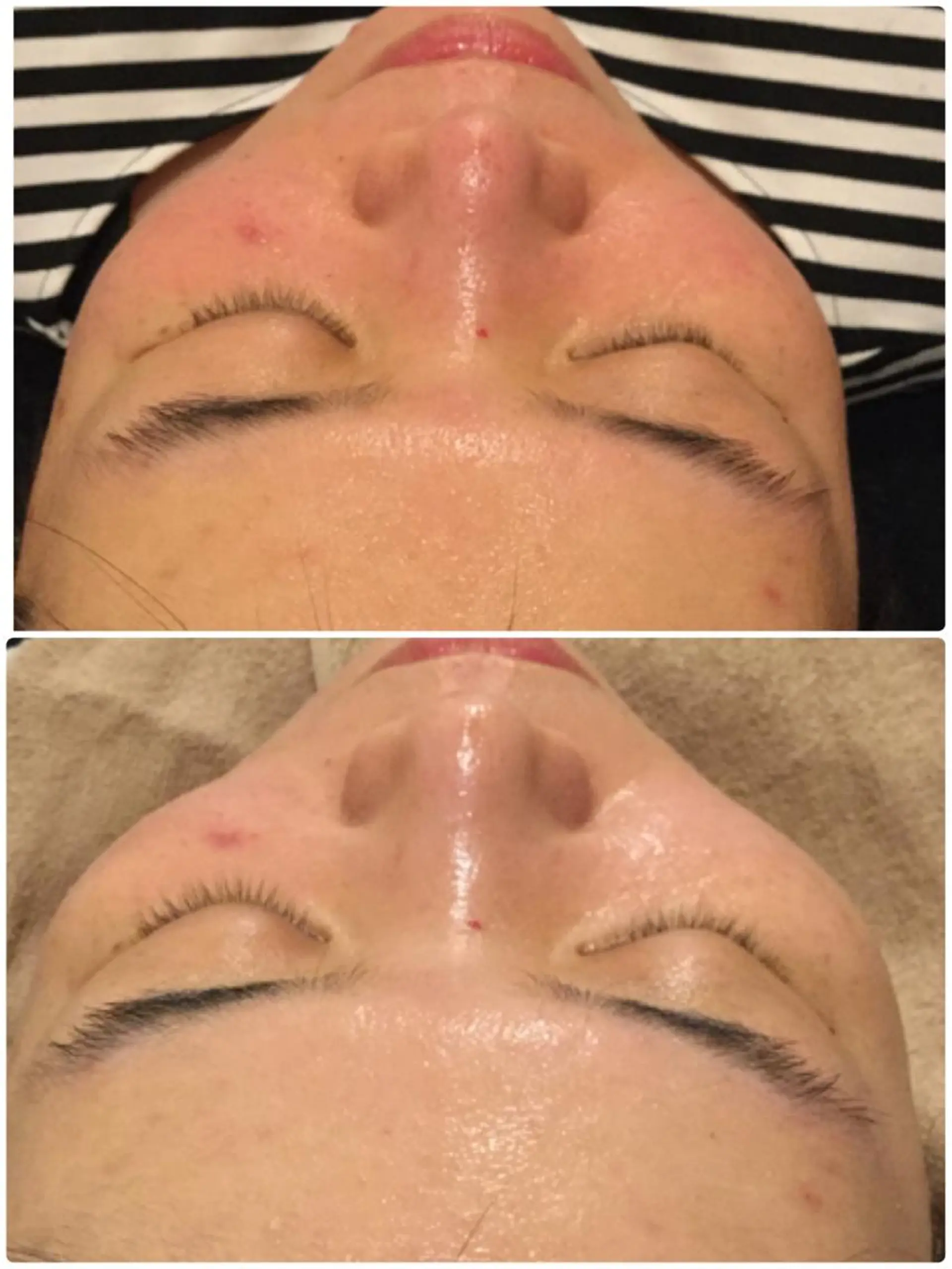 エステ 【リベルハーブピーリング認定店】敏感肌・美白脱毛専門店Dione立川店所属・Dione 立川店のエステ・リラクイメージ