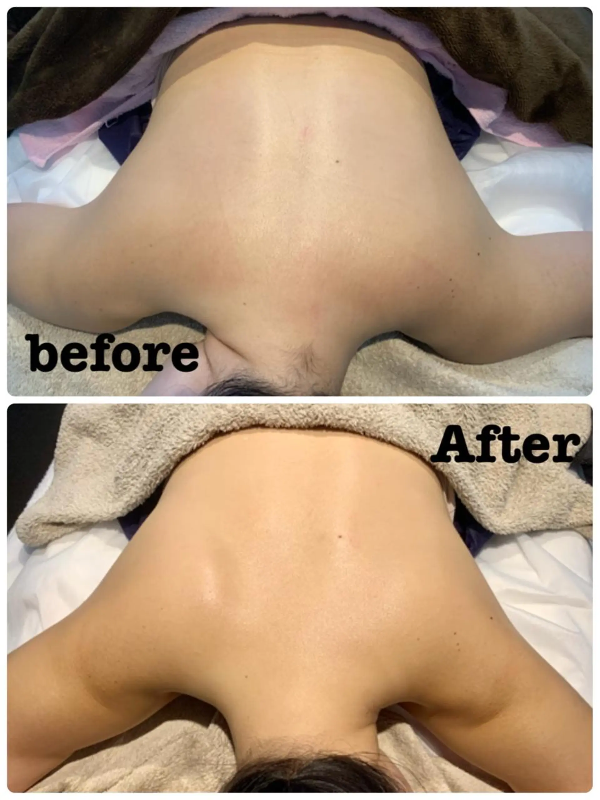 エステ リラク リラクゼーションエステサロン🌺肌質改善イアリイ所属・肌質再生 〜イア🌺リイ〜のエステ・リラクイメージ