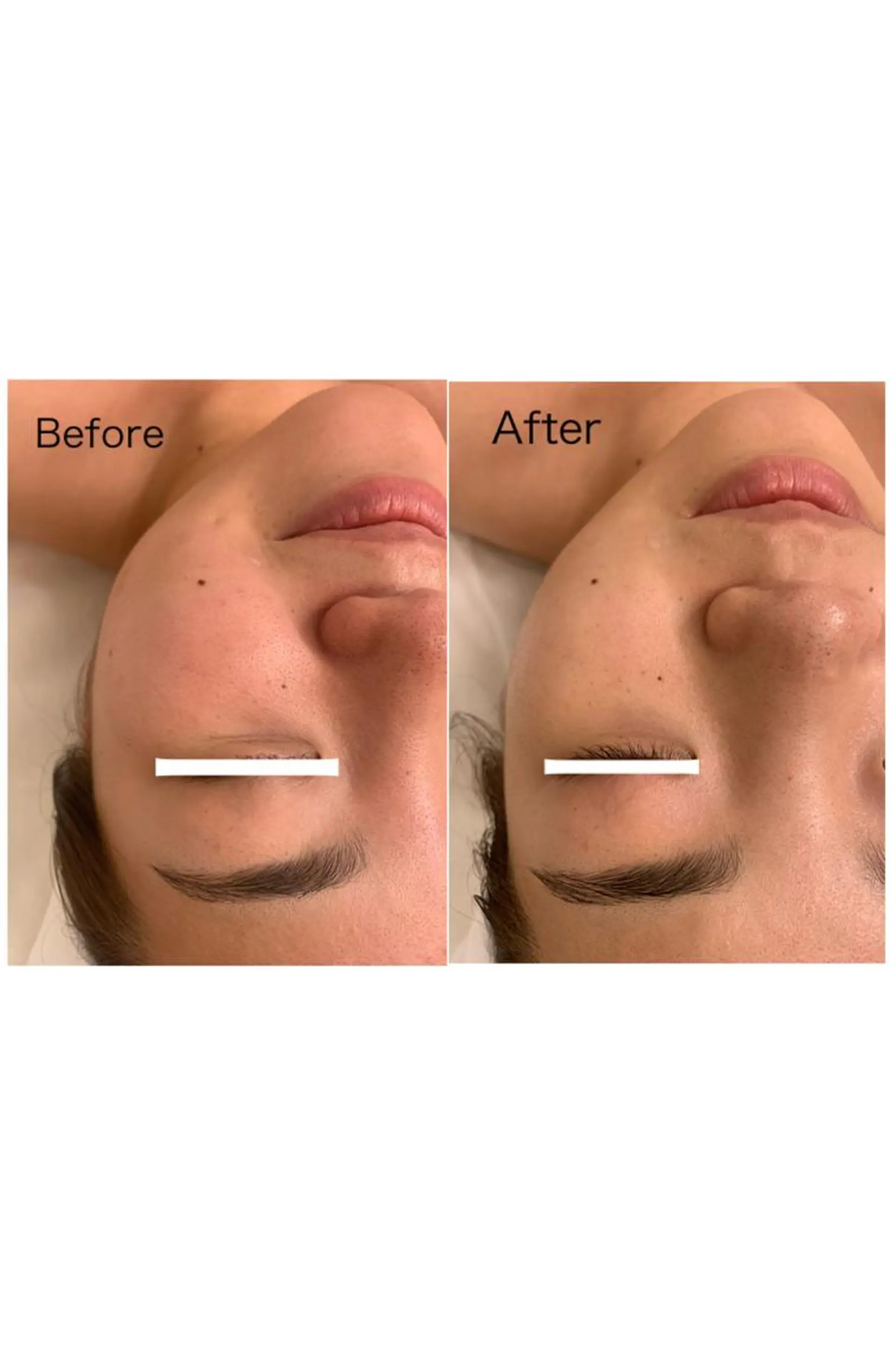 ナリスビューティサロンあべの所属・肌質改善/ツヤ肌作り /松本杏奈のエステ・リラクイメージ