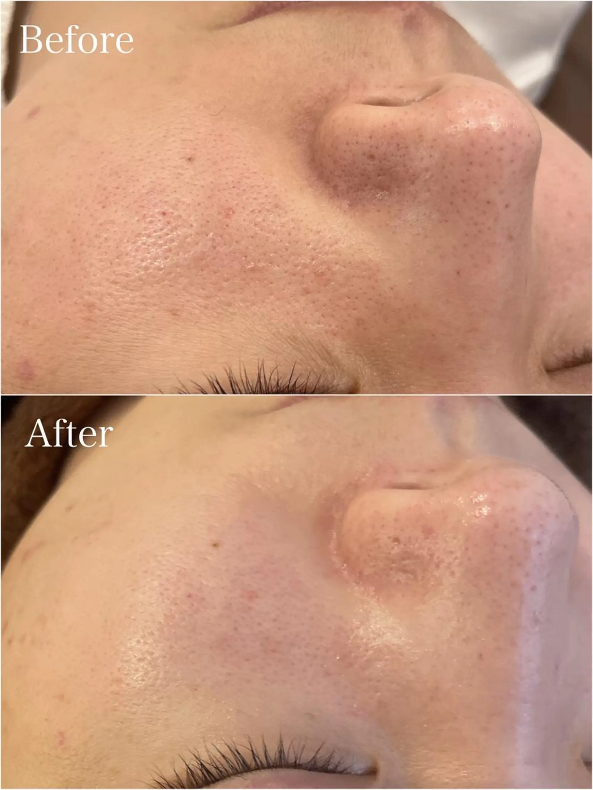 Freude所属・Freude Yamaguchiのマツエク・マツパデザイン