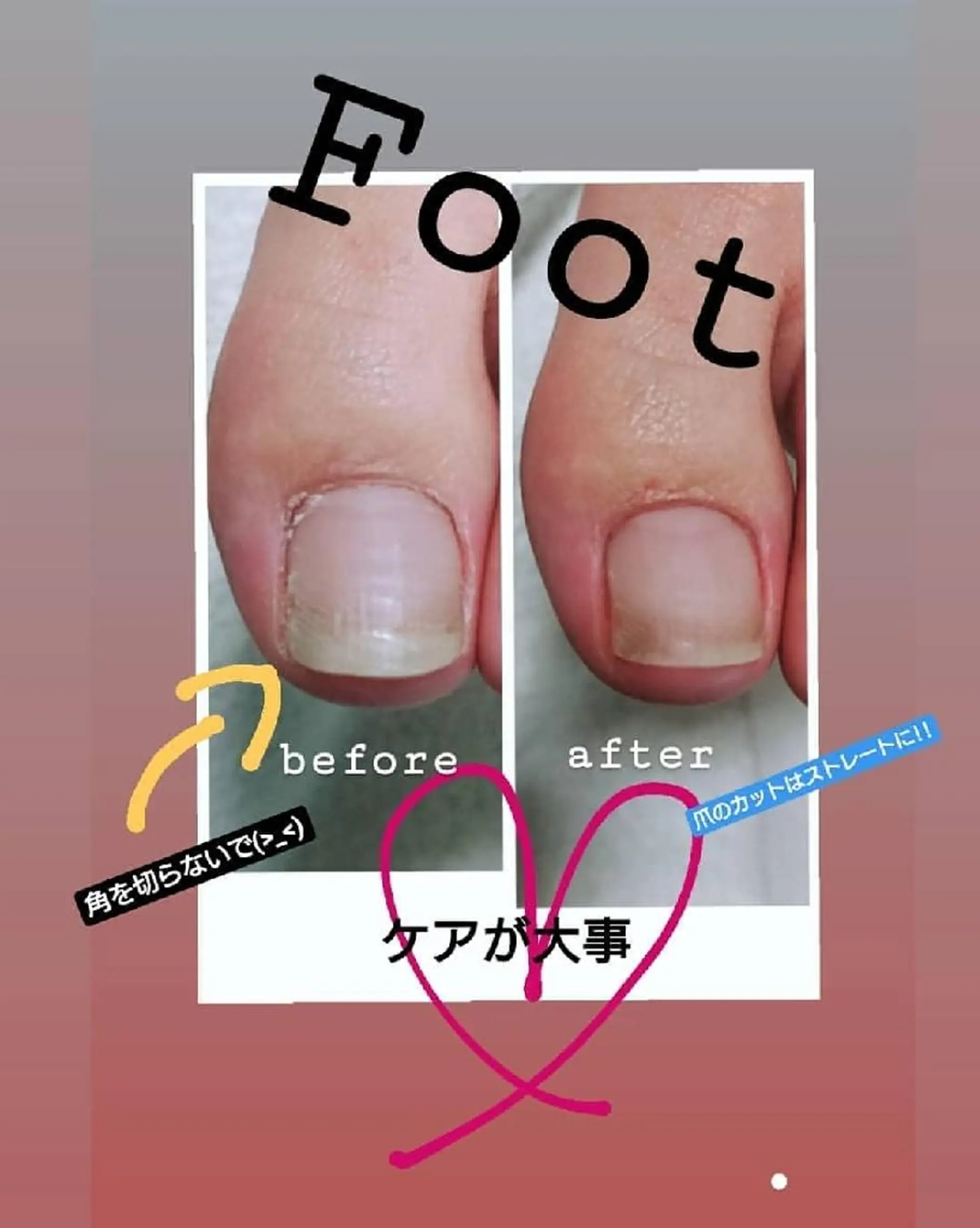 ネイル フットネイル フットネイル 市川駅 ✿中津のネイルデザイン